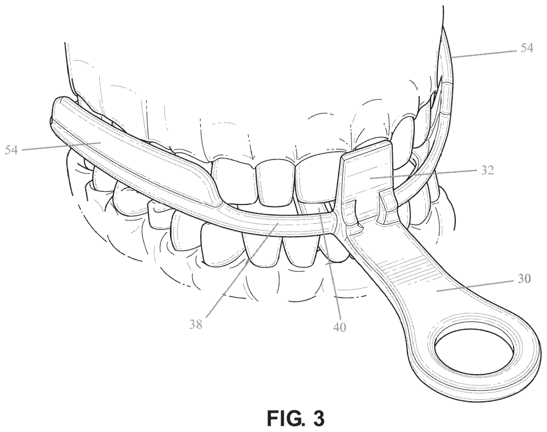 Patent US12472421 Figure 3 – Dental guard and tray and method of forming such