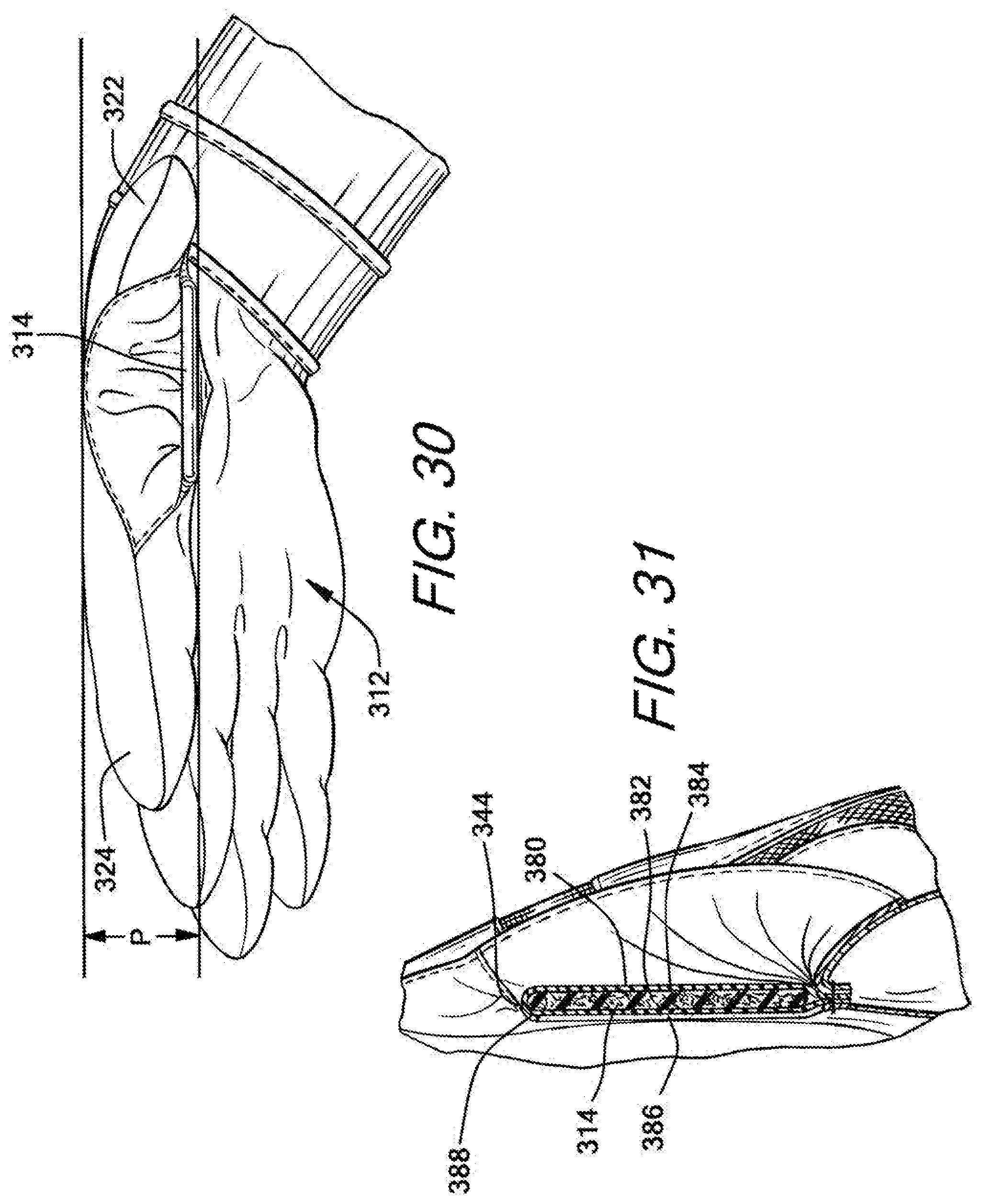 Patent US12472422 Figure 14 – Batting glove and cushioning apparatus