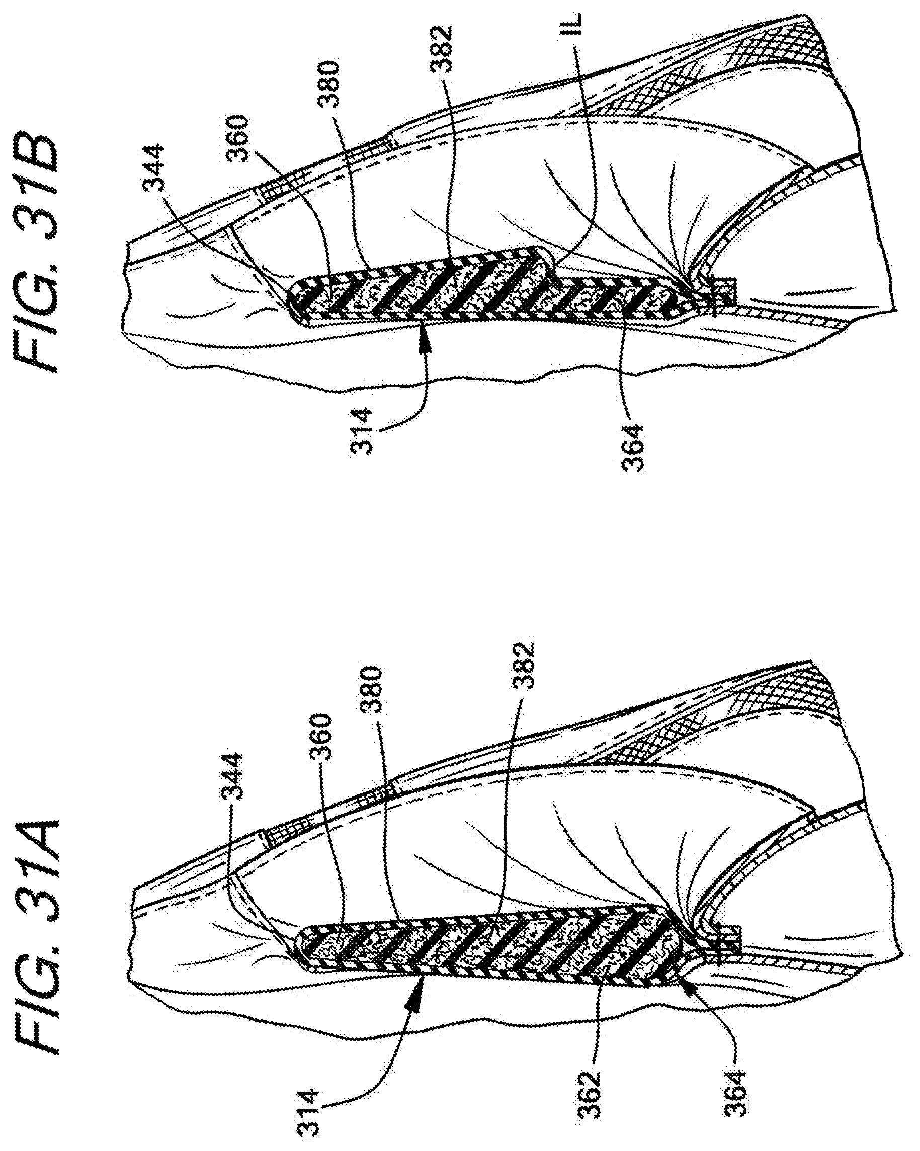 Patent US12472422 Figure 15 – Batting glove and cushioning apparatus