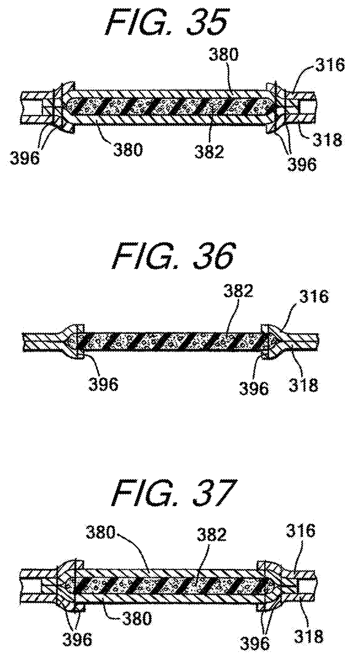 Patent US12472422 Figure 19 – Batting glove and cushioning apparatus