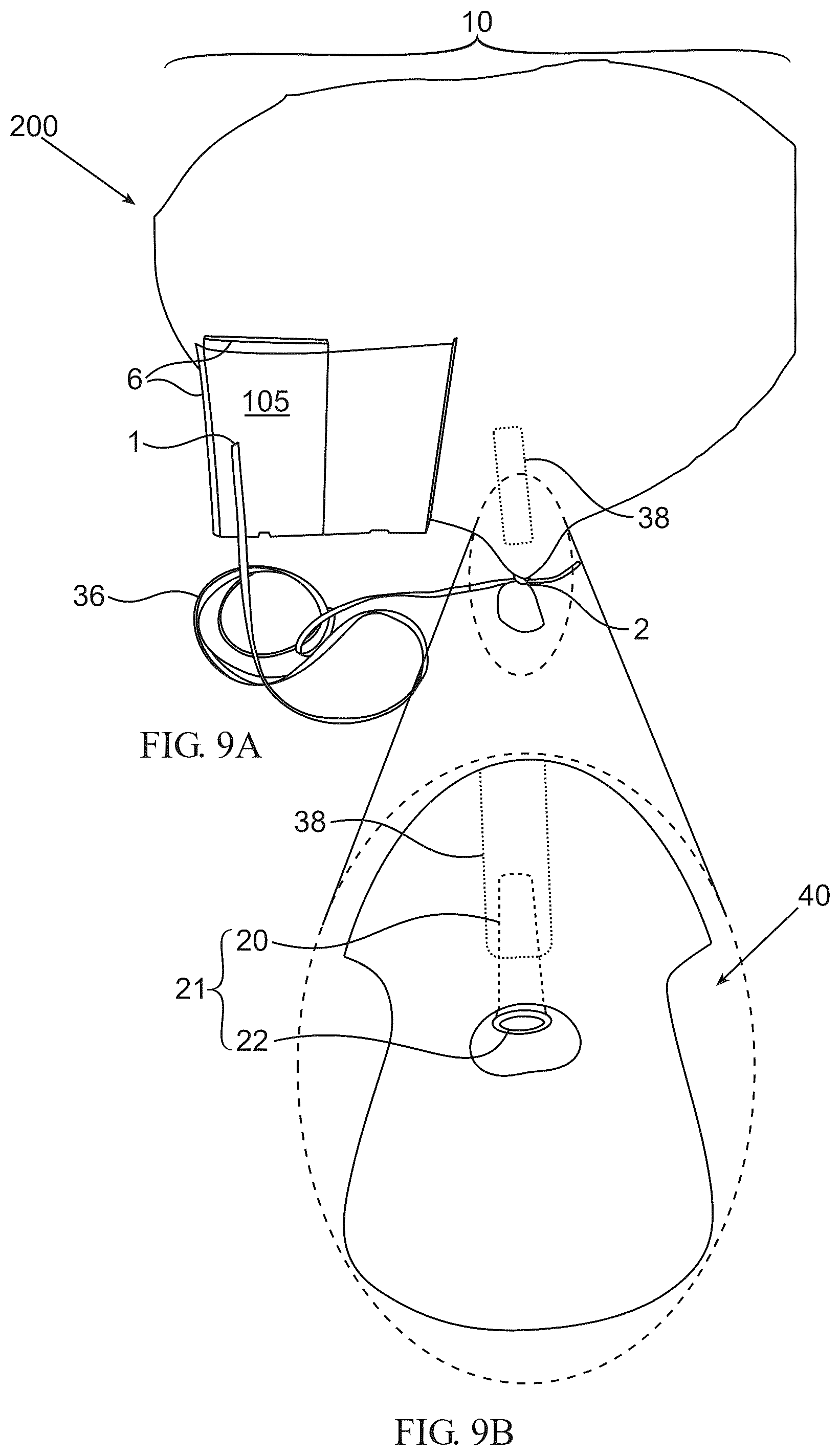 Patent US12472443 Figure 7 – Capsuled balloons and inflation devices for such capsuled balloons