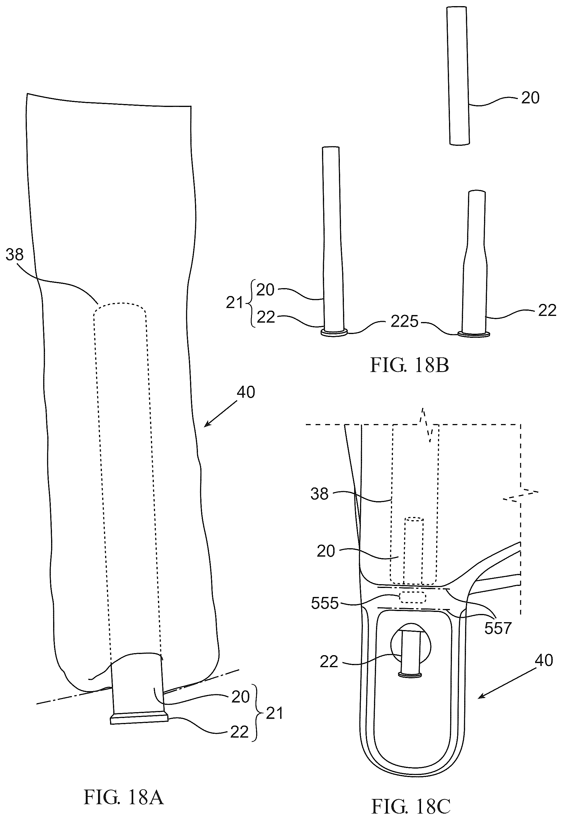 Patent US12472443 Figure 14 – Capsuled balloons and inflation devices for such capsuled balloons