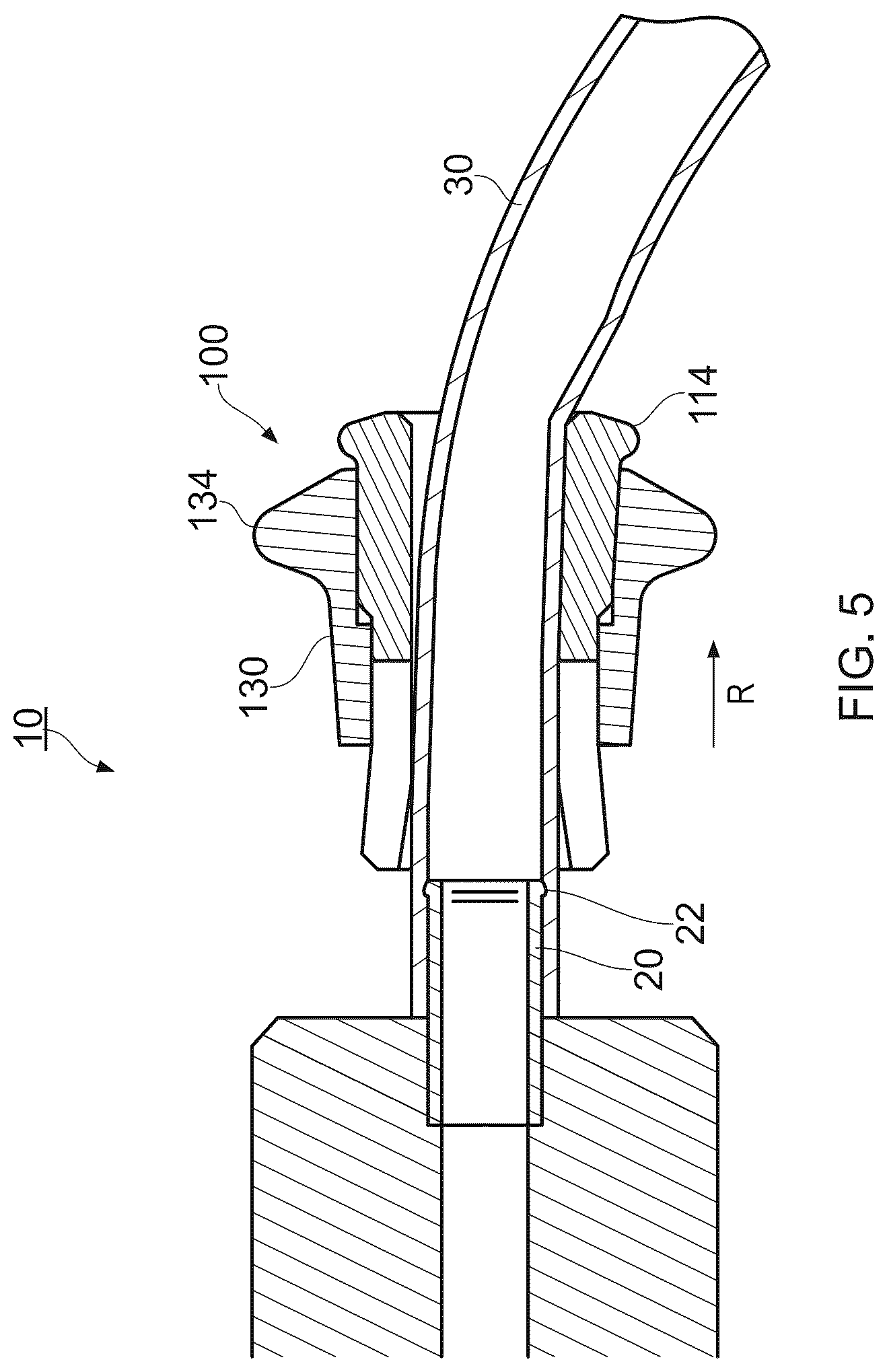 Patent US12472447 Figure 4 – Chromatography system and couplings therefor
