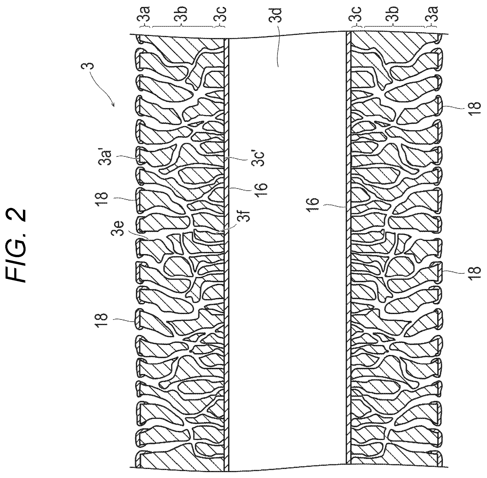 Patent US12472470 Figure 2 – Oxygenator and method for manufacturing same
