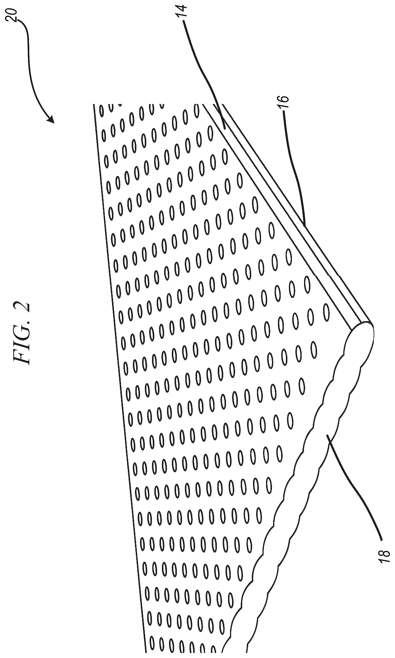 Patent US12472580 Figure 2 – Laser handheld trimming and welding device