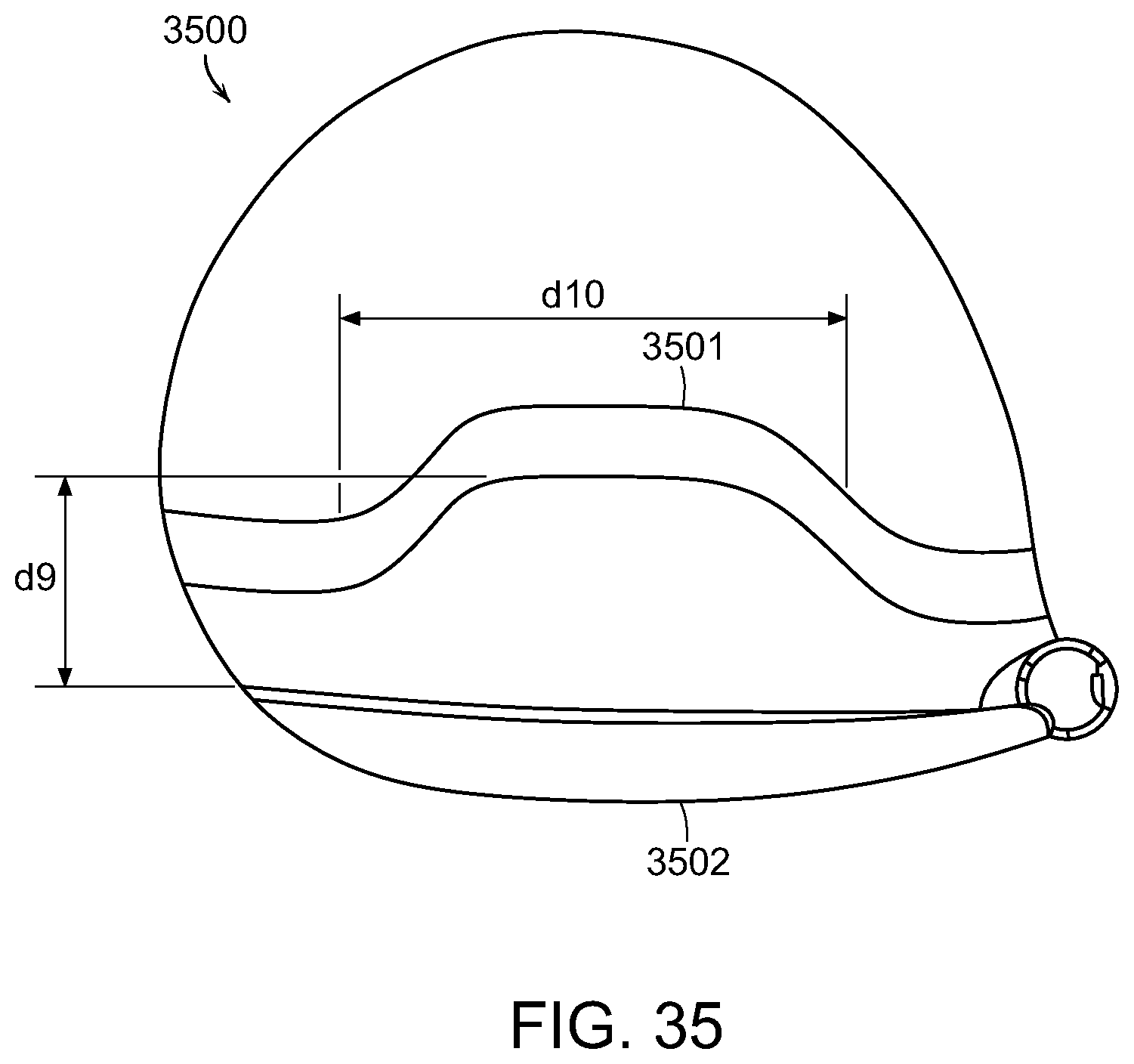 Patent US12472663 Figure 18 – Golf club head having a multi-material face and method of manufacture