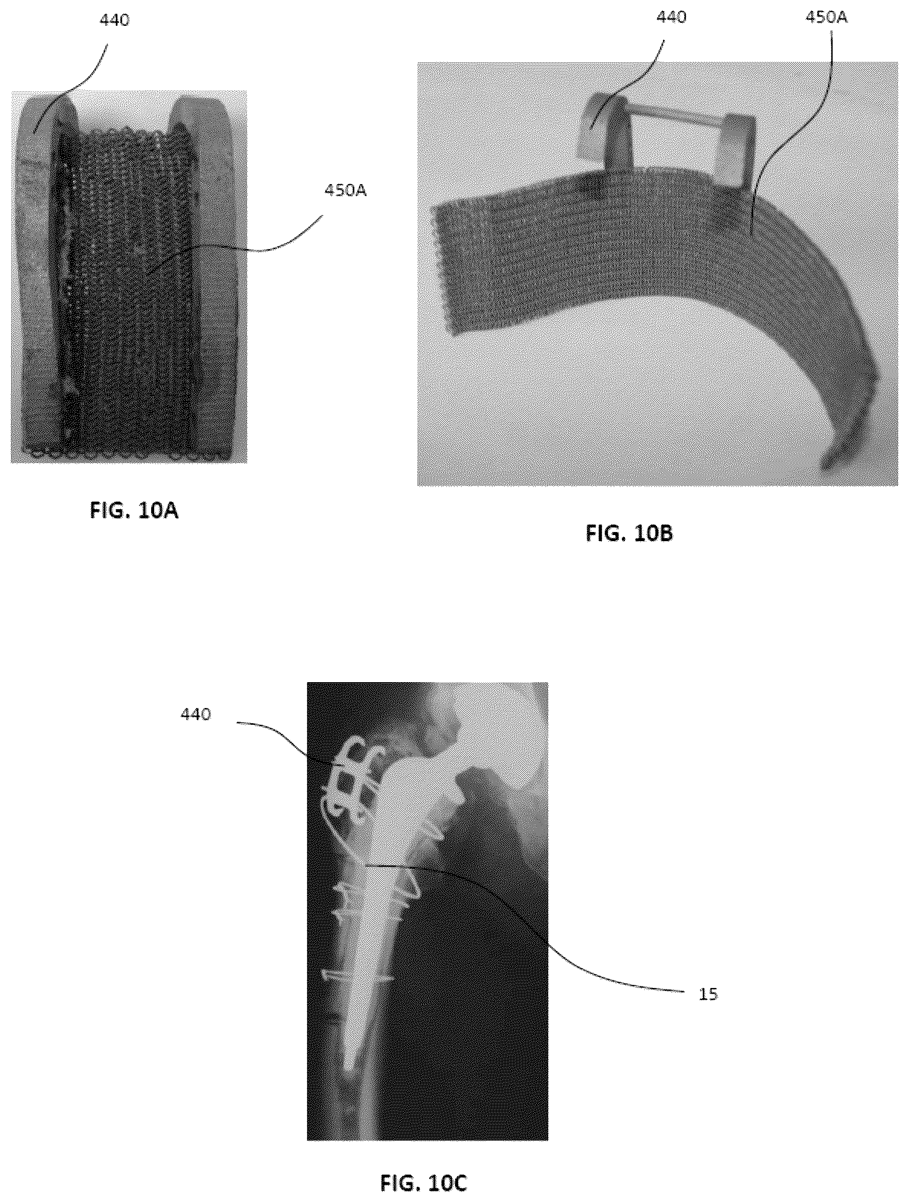 Patent US12472679 Figure 8 – Porous structures produced by additive layer manufacturing