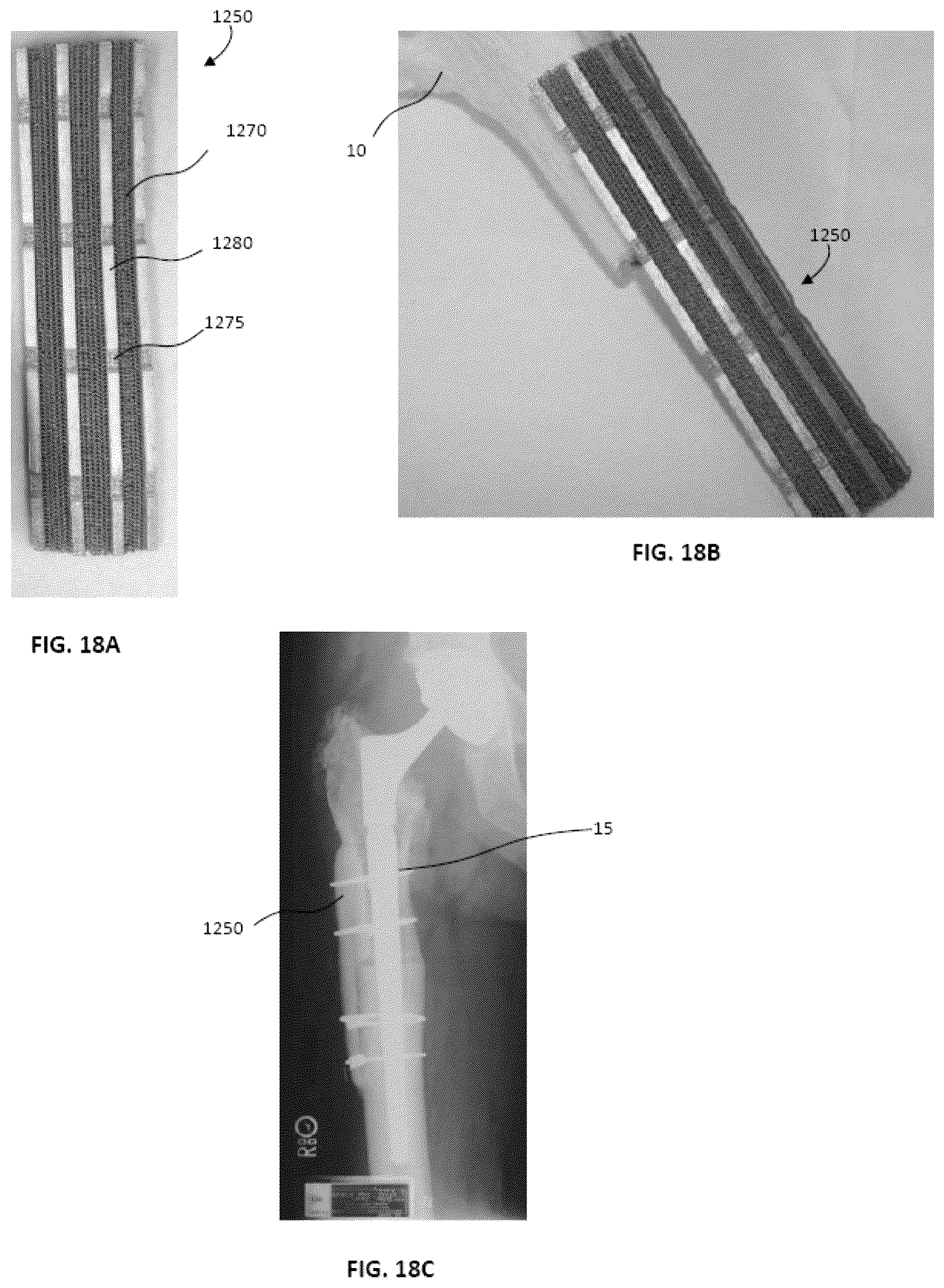Patent US12472679 Figure 14 – Porous structures produced by additive layer manufacturing