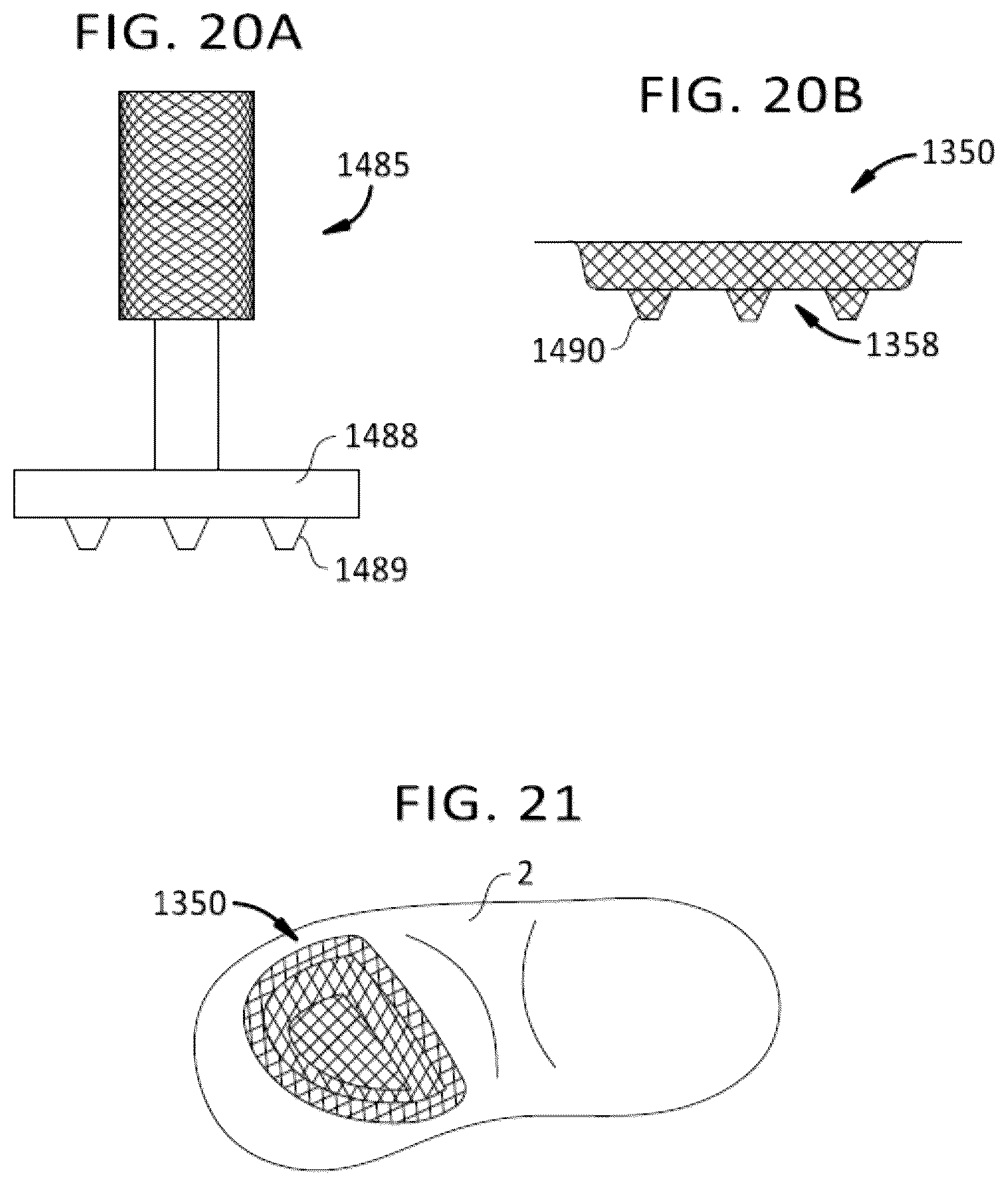 Patent US12472679 Figure 16 – Porous structures produced by additive layer manufacturing