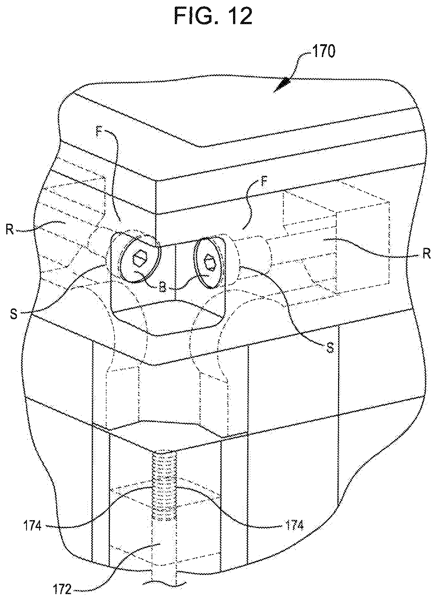Patent US12479485 Figure 10 – Thermal cart
