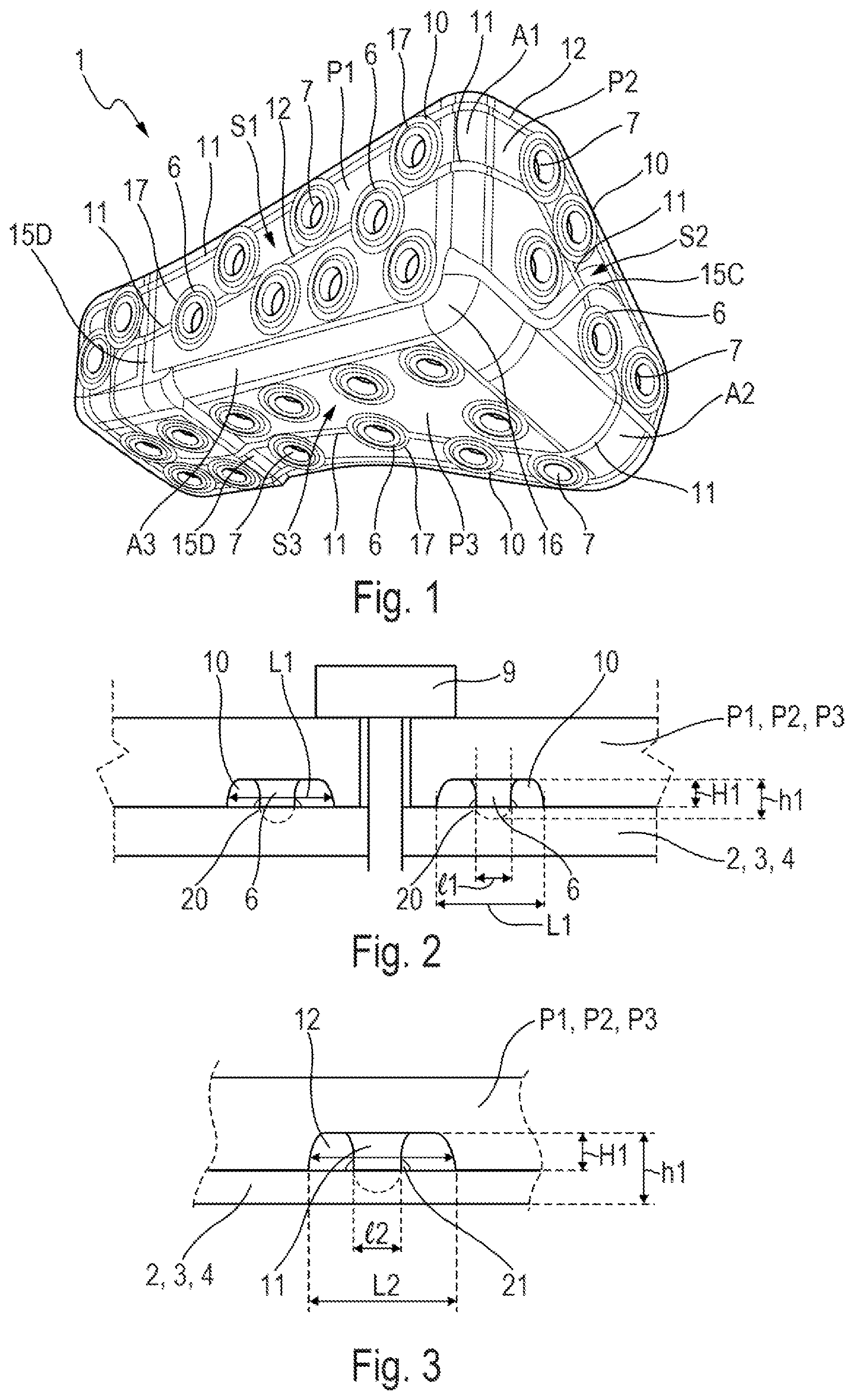 Patent US12479562 Figure 1 – Flexible corner fitting intended to contribute to a connection between at least three walls of at least one aircraft box structure