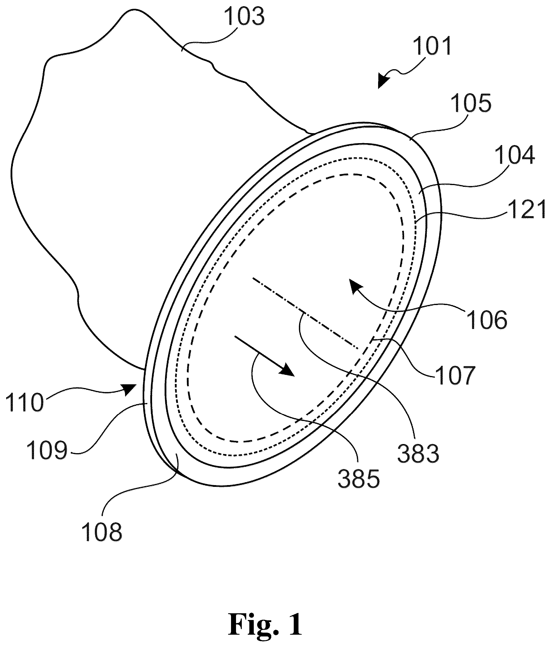 Patent US12479671 Figure 1 – Connection device for transferring bulk material goods and port system