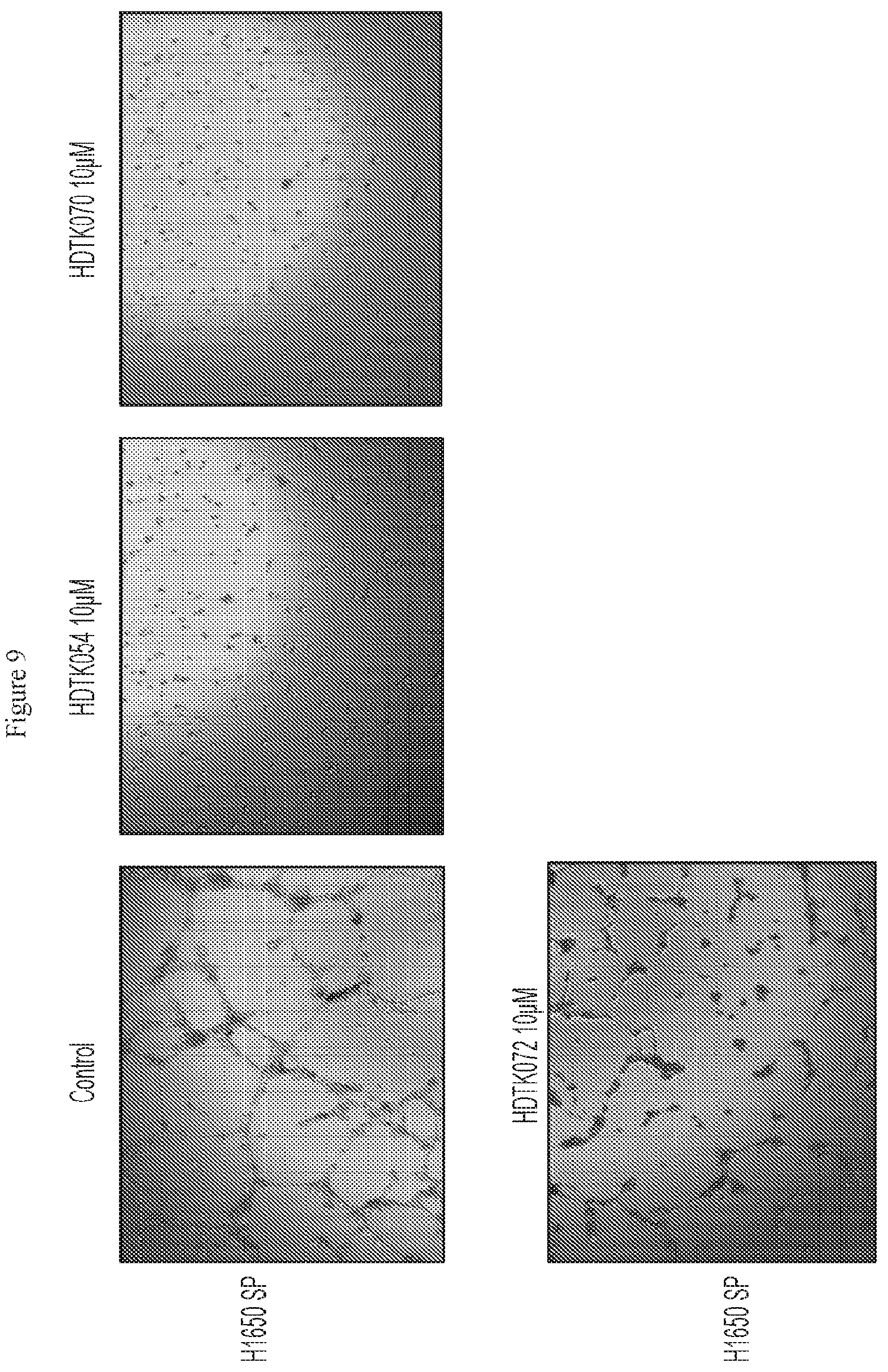 Patent US12479807 Figure 10 – Methods using HDAC11 inhibitors