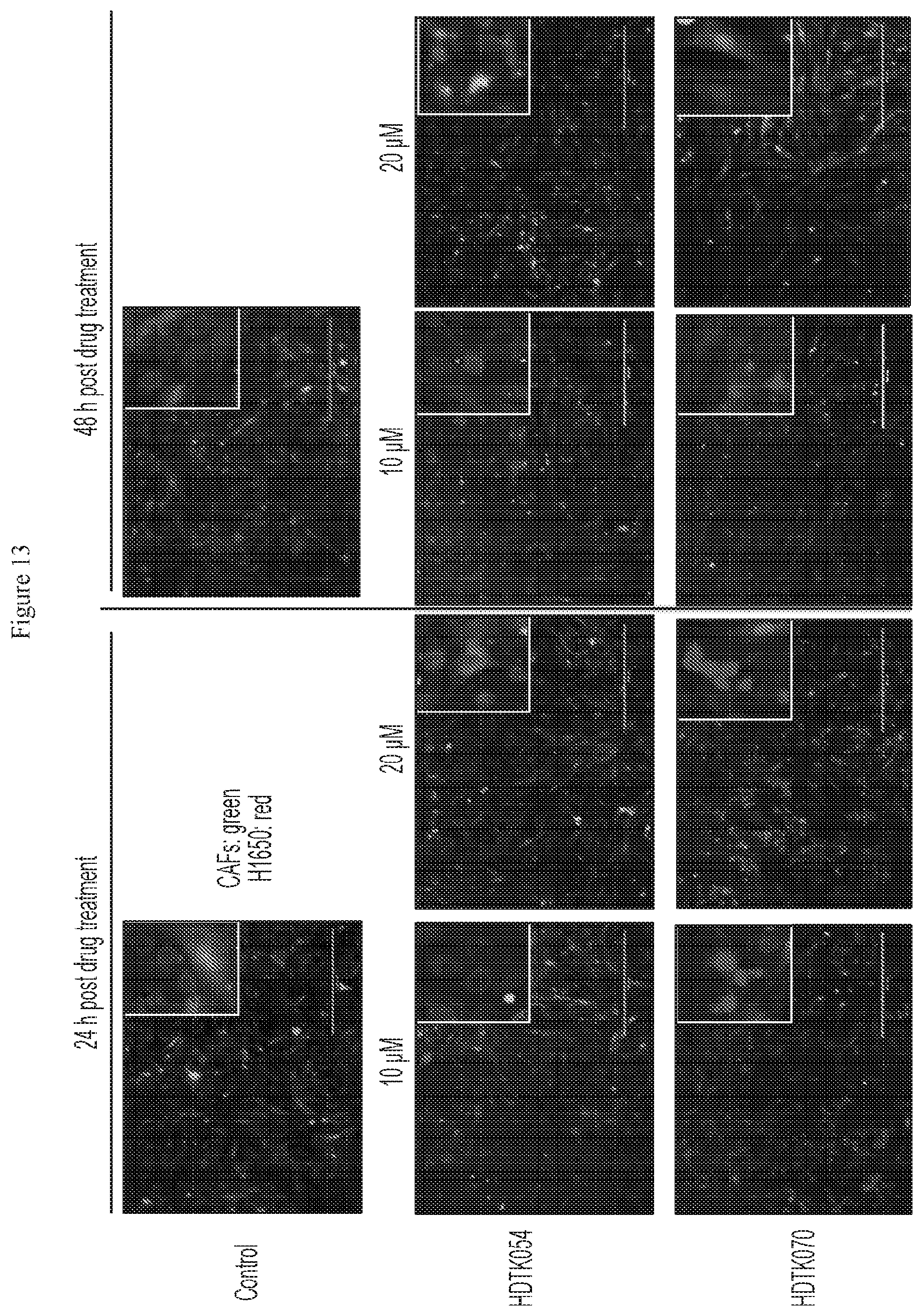 Patent US12479807 Figure 14 – Methods using HDAC11 inhibitors