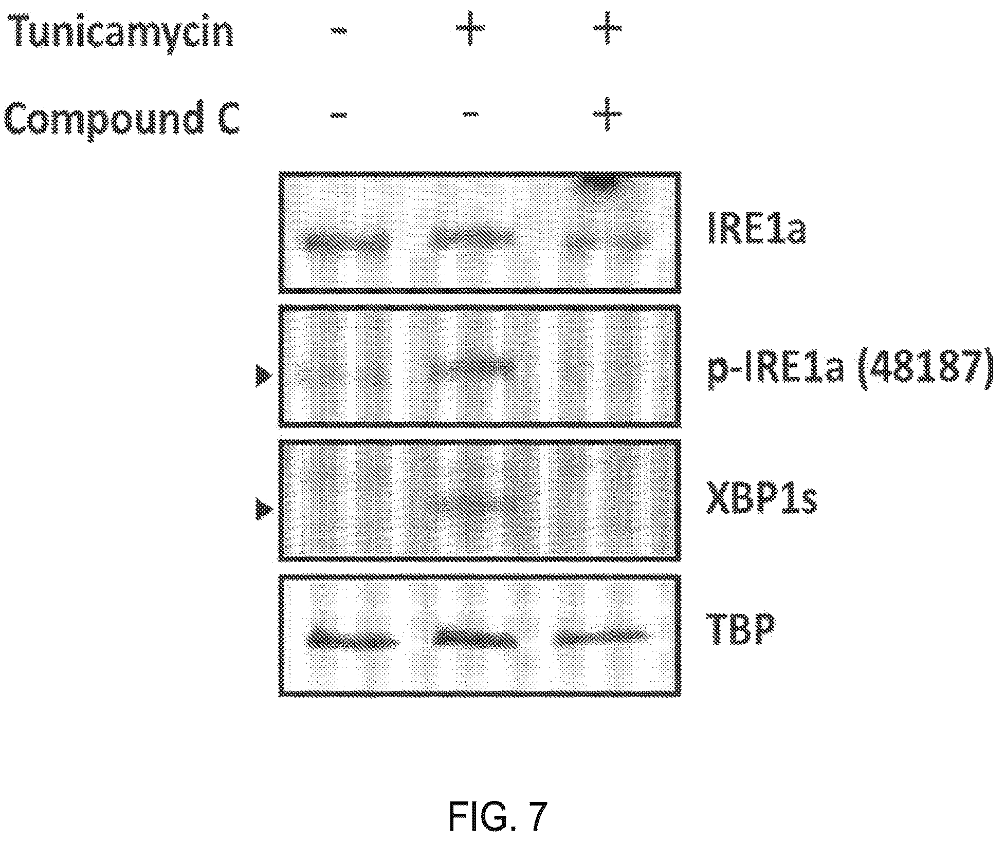 Patent US12479818 Figure 7 – Treatment of fibrosis with IRE1 small molecule inhibitors