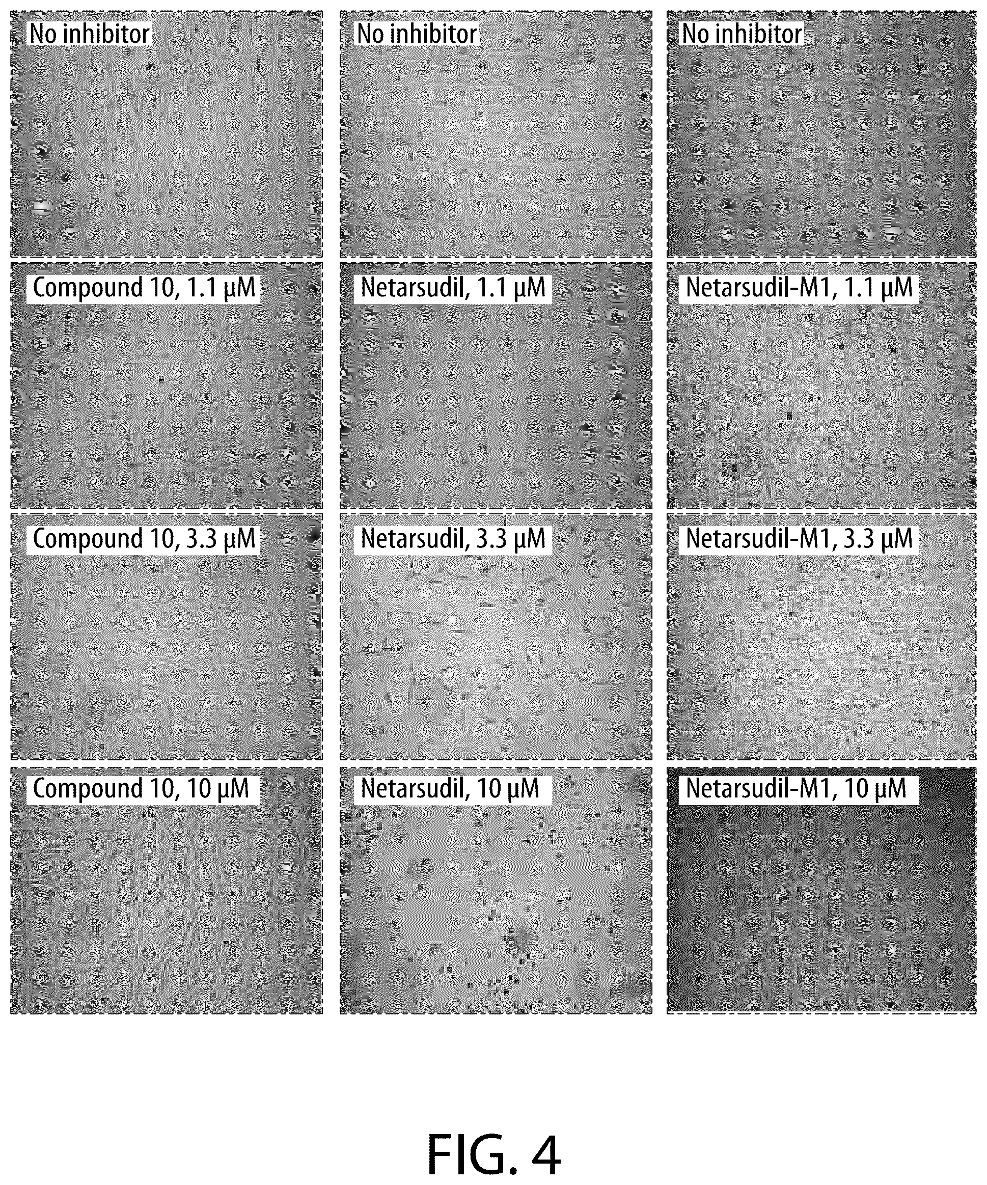 Patent US12479866 Figure 4 – Boron-containing rho kinase inhibitors