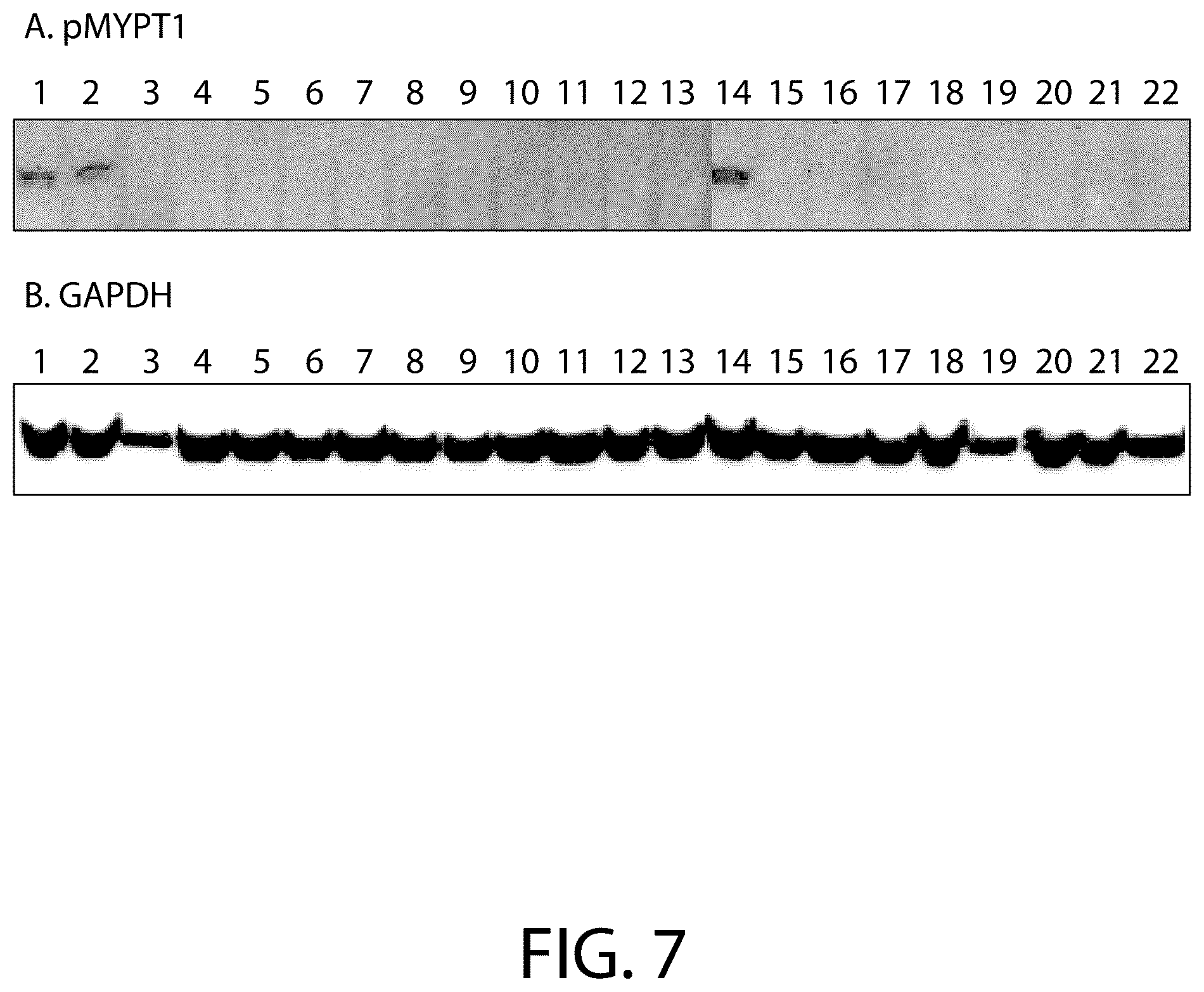 Patent US12479866 Figure 7 – Boron-containing rho kinase inhibitors