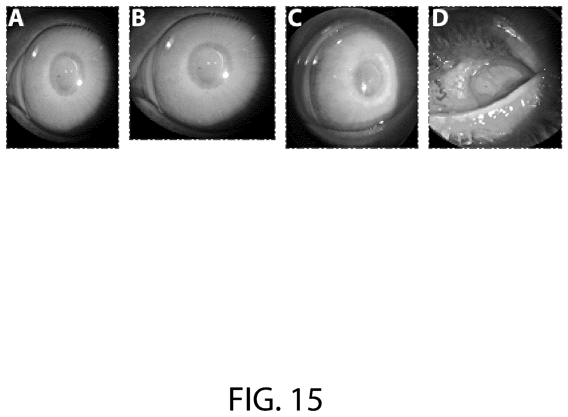 Patent US12479866 Figure 15 – Boron-containing rho kinase inhibitors