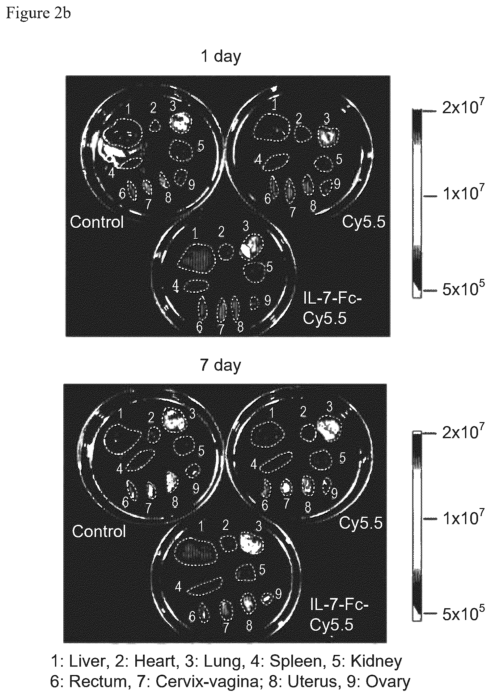 Patent US12479898 Figure 3 – Pharmaceutical composition comprising immunoglobulin fc-fused interleukin-7 fusion protein for preventing or treating human papillomavirus-caused diseases