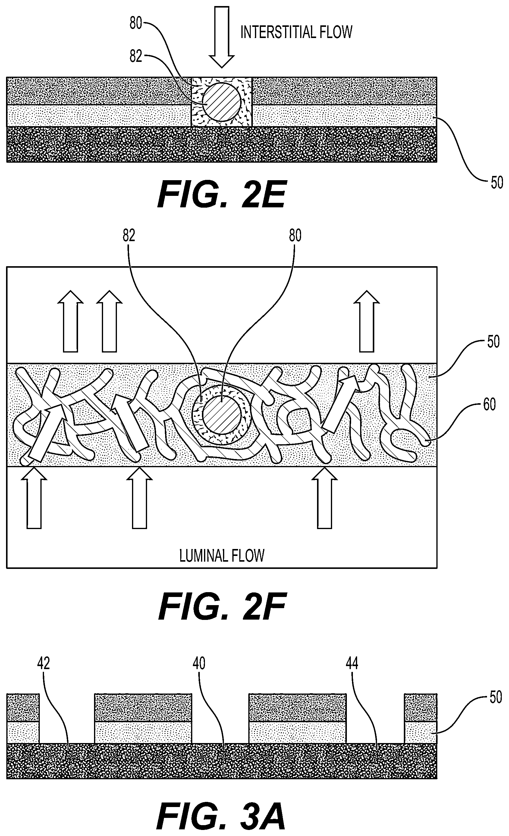 Patent US12480079 Figure 5 – Fluidic platforms for perfusable vascularized tissues with infiltrates