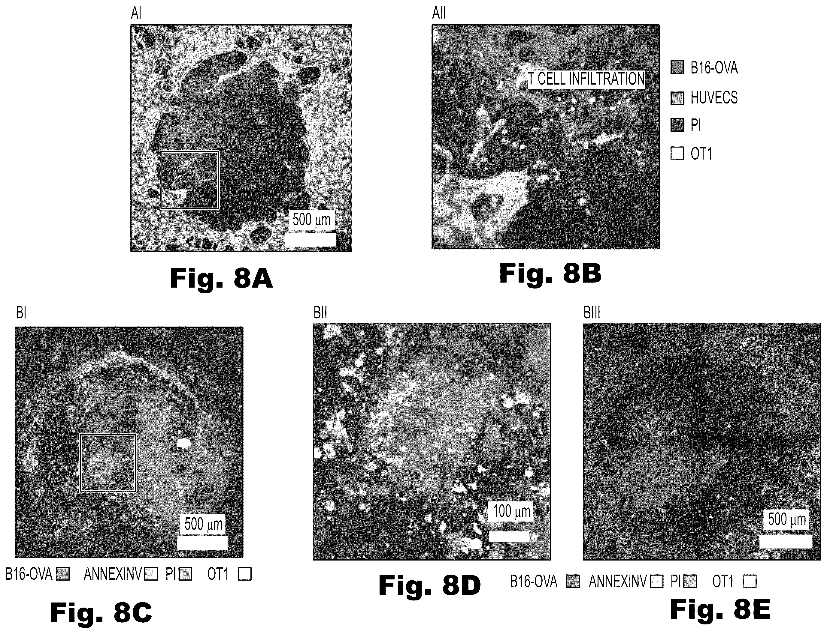 Patent US12480079 Figure 17 – Fluidic platforms for perfusable vascularized tissues with infiltrates