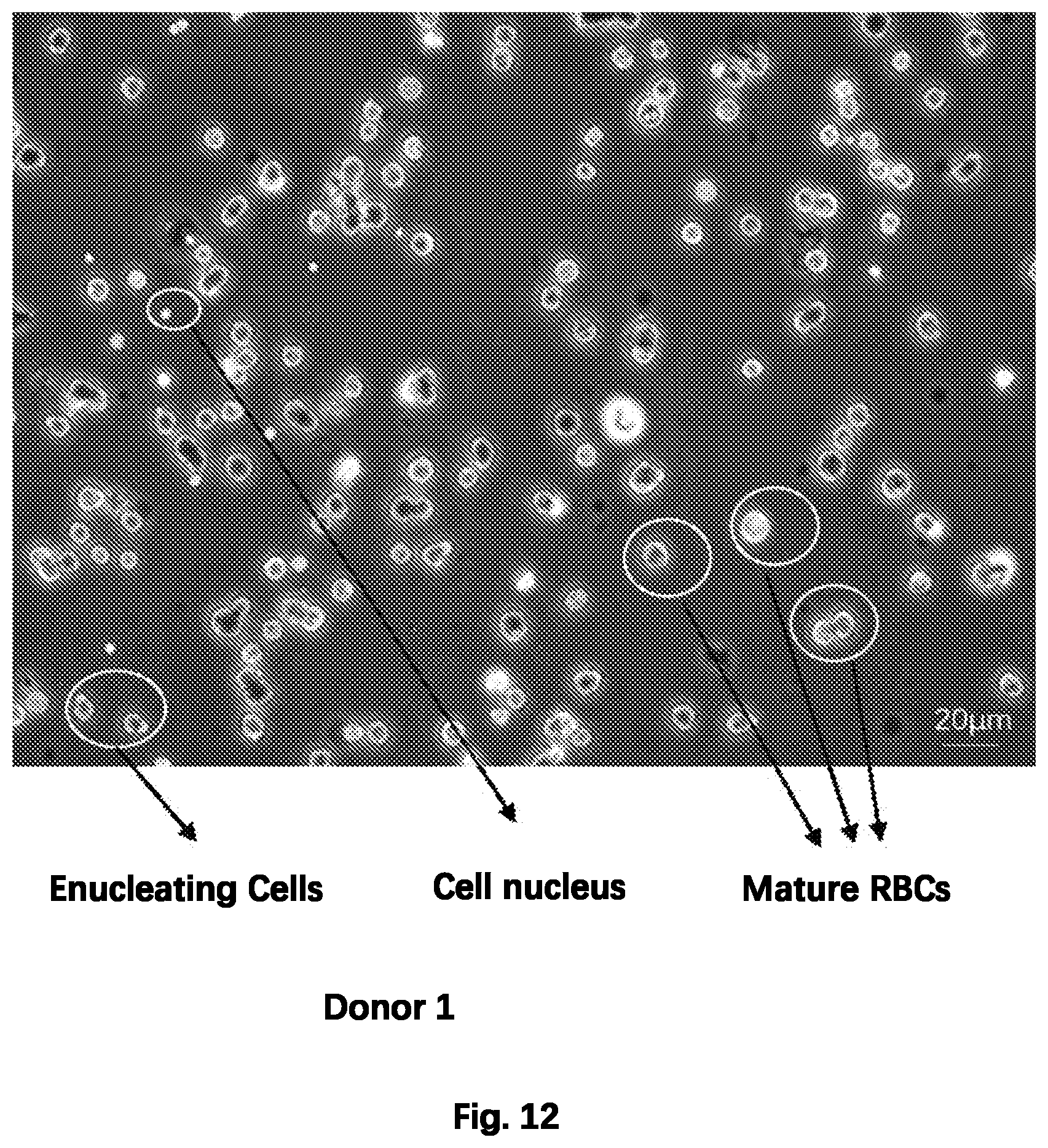 Patent US12480092 Figure 12 – Method for preparing mature red blood cells in vitro using peripheral blood