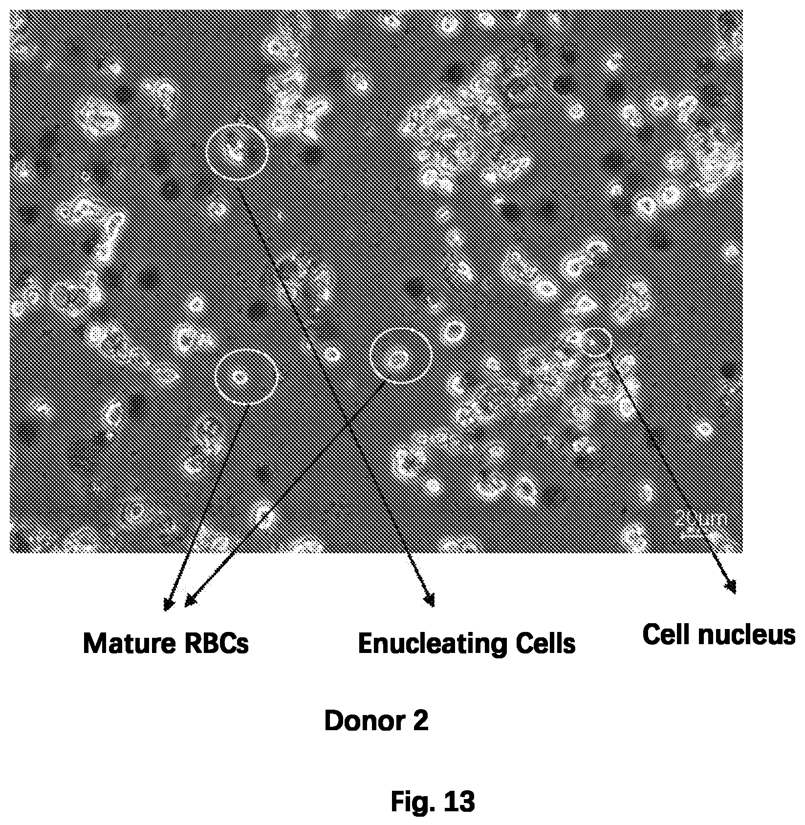 Patent US12480092 Figure 13 – Method for preparing mature red blood cells in vitro using peripheral blood