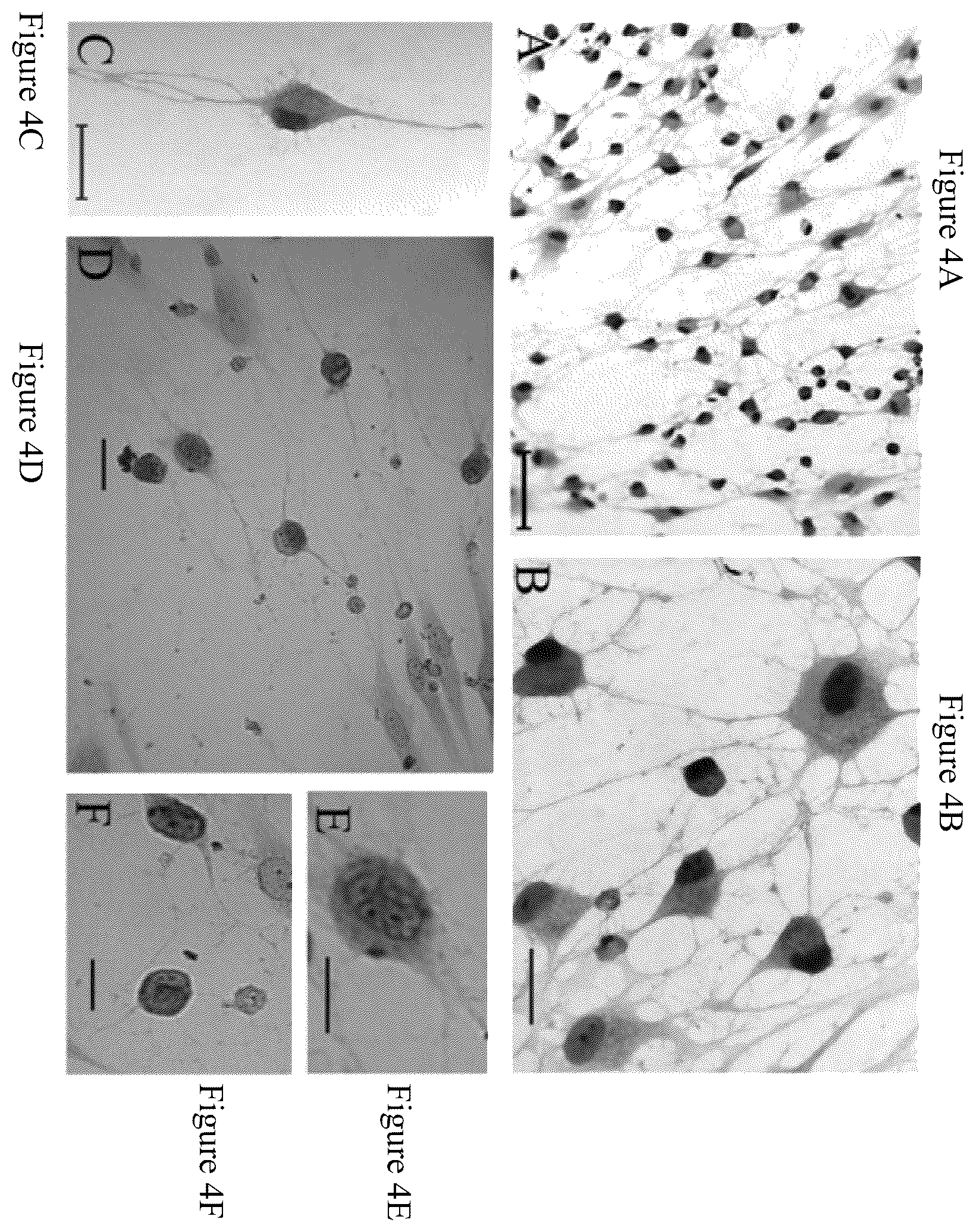 Patent US12480095 Figure 4 – Multifunctional immature dental pulp stem cells and therapeutic applications