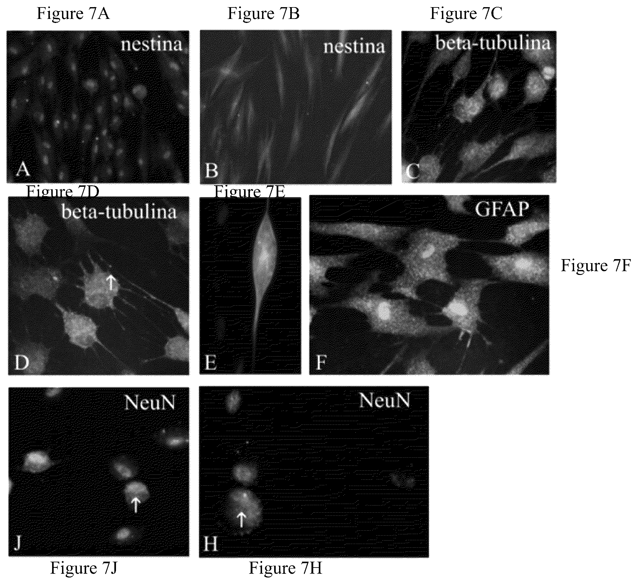 Patent US12480095 Figure 7 – Multifunctional immature dental pulp stem cells and therapeutic applications