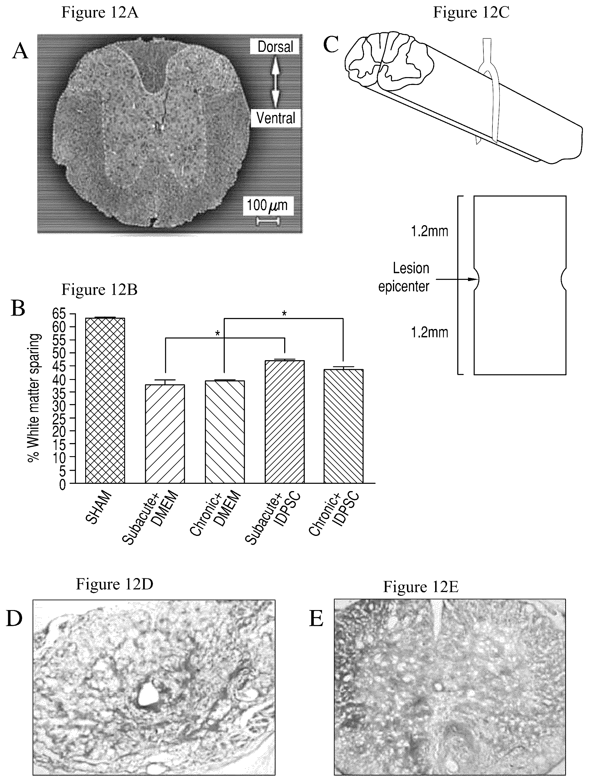 Patent US12480095 Figure 12 – Multifunctional immature dental pulp stem cells and therapeutic applications