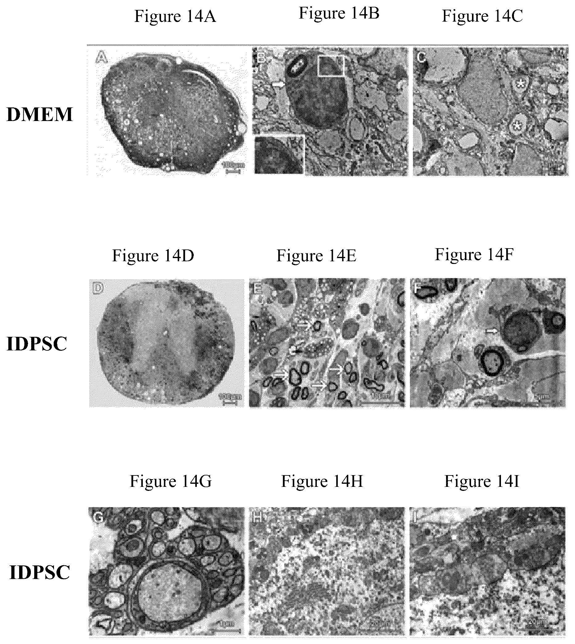 Patent US12480095 Figure 14 – Multifunctional immature dental pulp stem cells and therapeutic applications