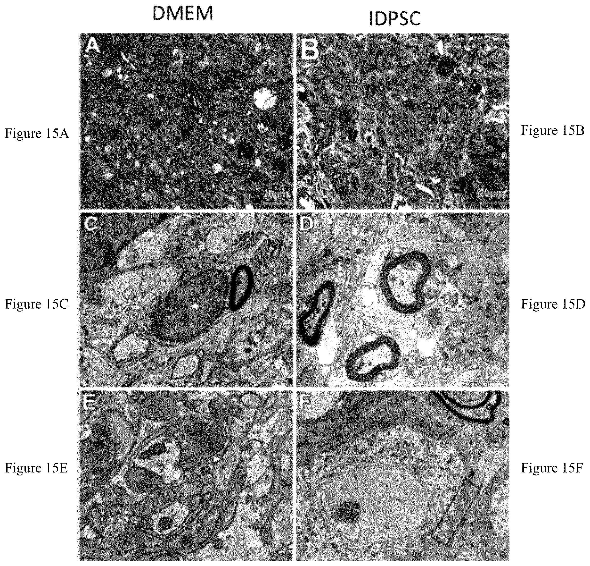 Patent US12480095 Figure 15 – Multifunctional immature dental pulp stem cells and therapeutic applications