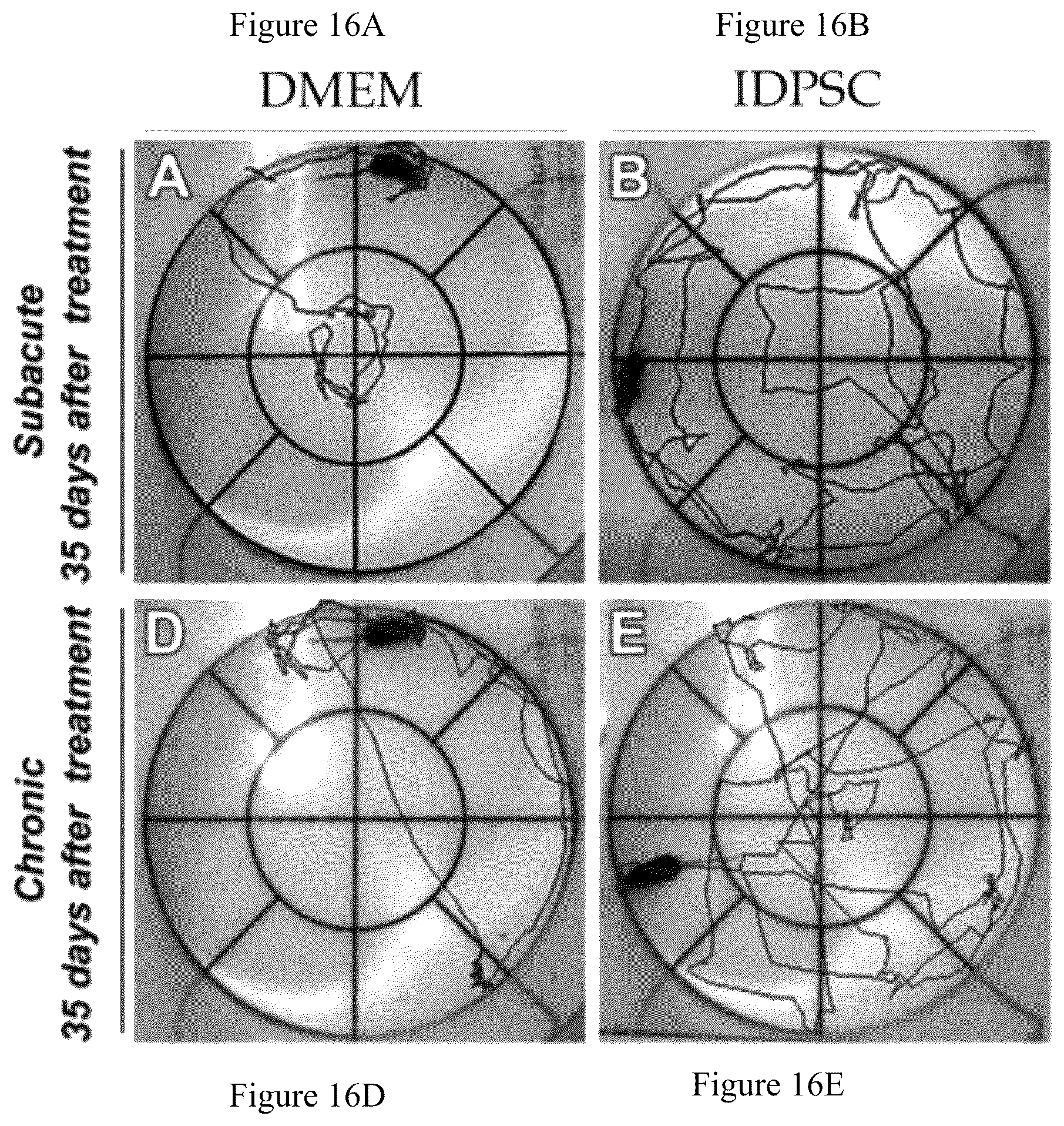 Patent US12480095 Figure 16 – Multifunctional immature dental pulp stem cells and therapeutic applications