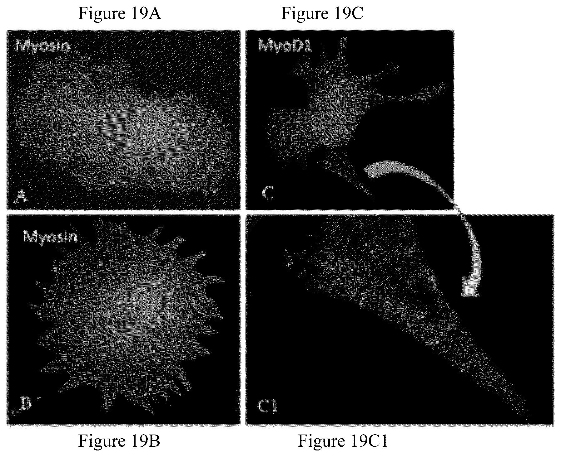 Patent US12480095 Figure 19 – Multifunctional immature dental pulp stem cells and therapeutic applications