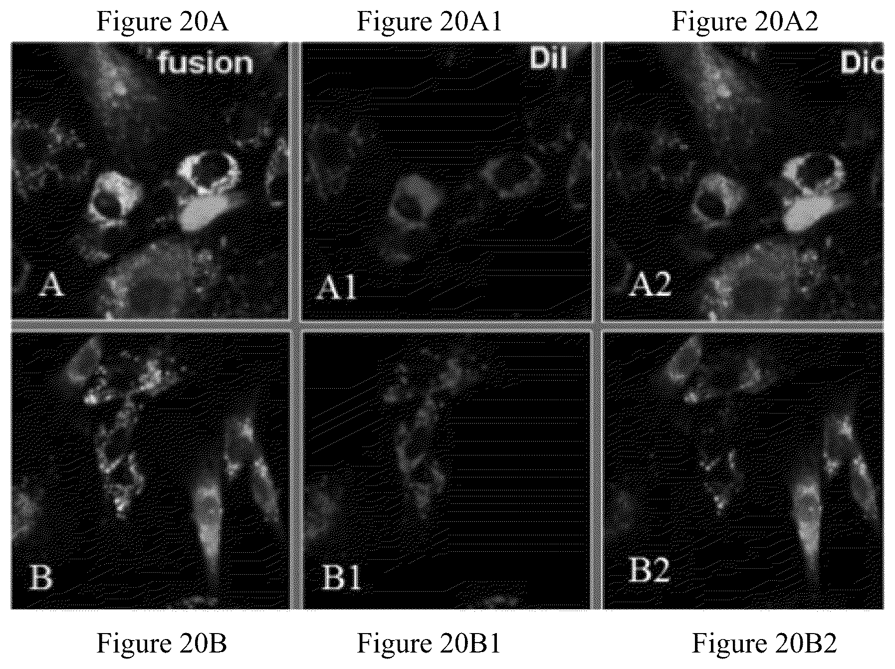 Patent US12480095 Figure 20 – Multifunctional immature dental pulp stem cells and therapeutic applications