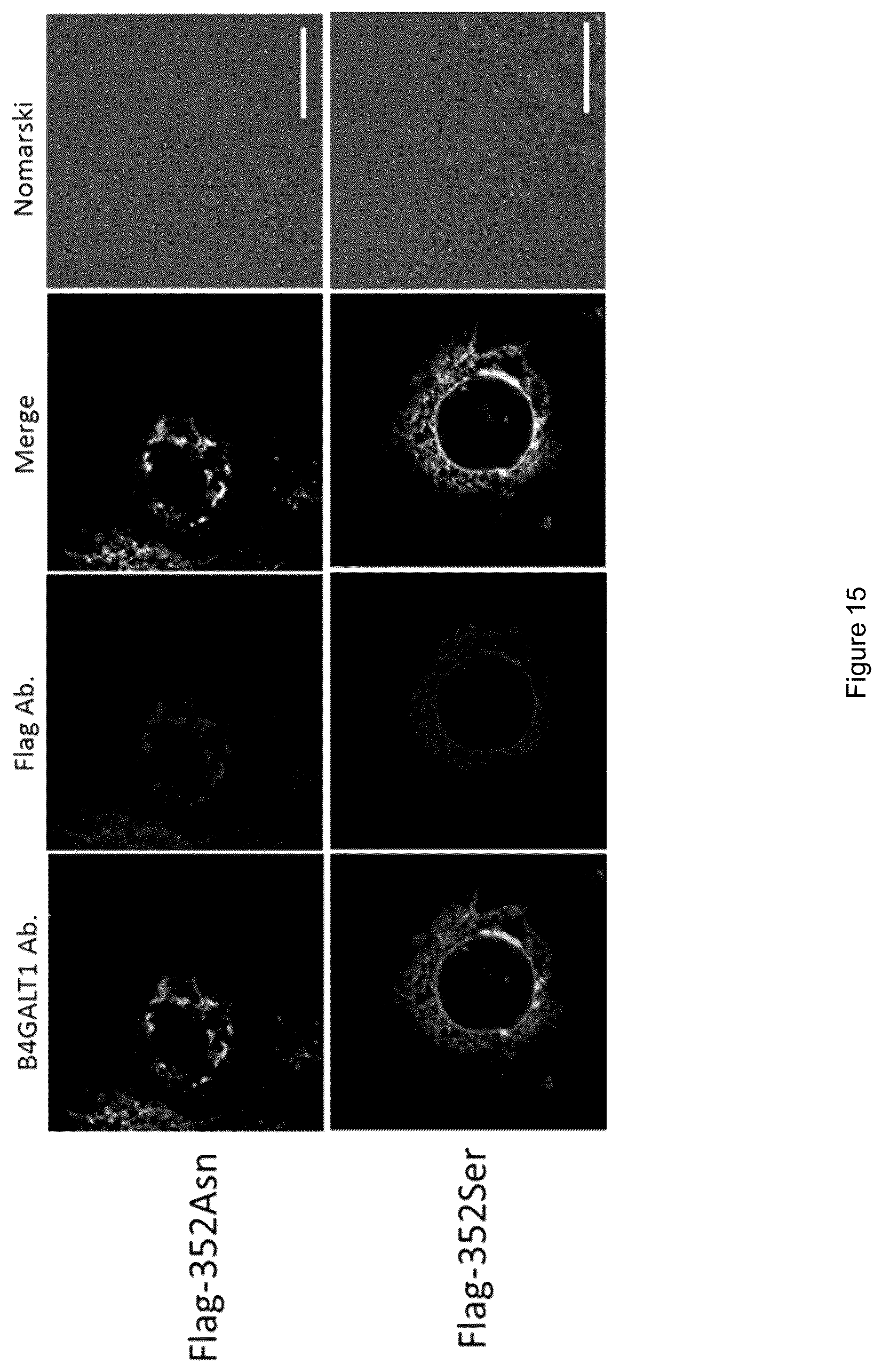 Patent US12480103 Figure 18 – B4GALT1 variants and uses thereof