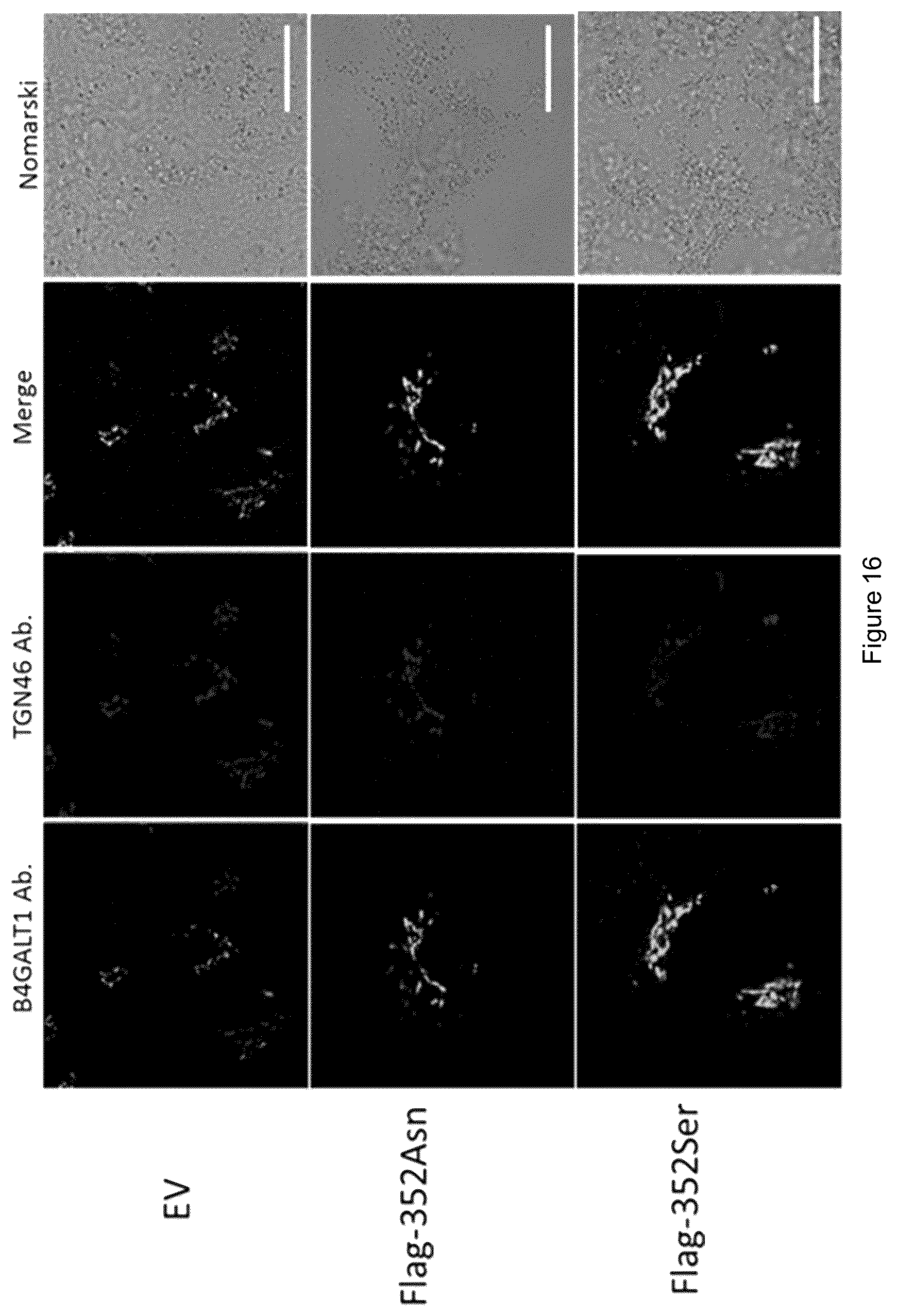 Patent US12480103 Figure 19 – B4GALT1 variants and uses thereof