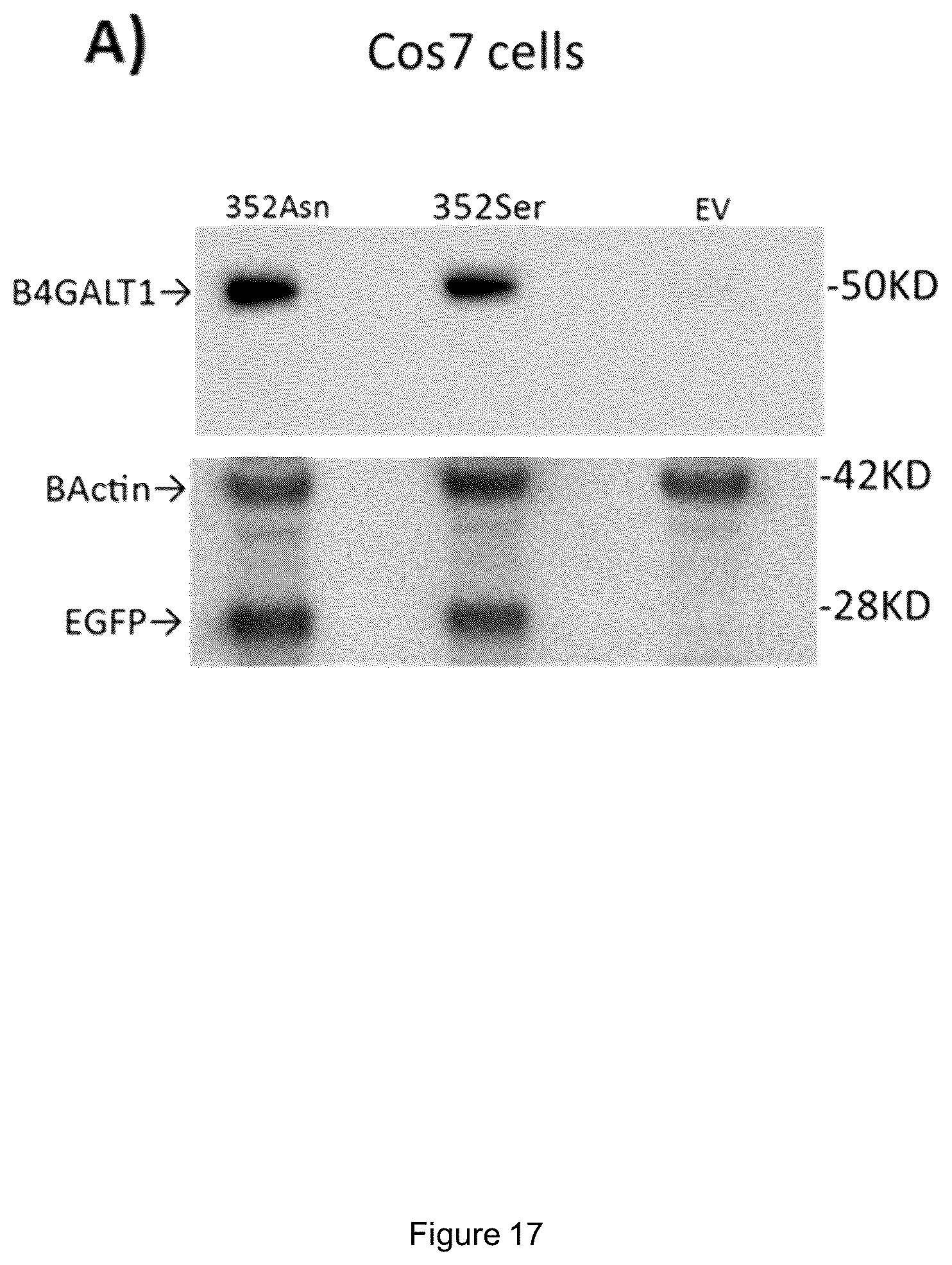 Patent US12480103 Figure 20 – B4GALT1 variants and uses thereof