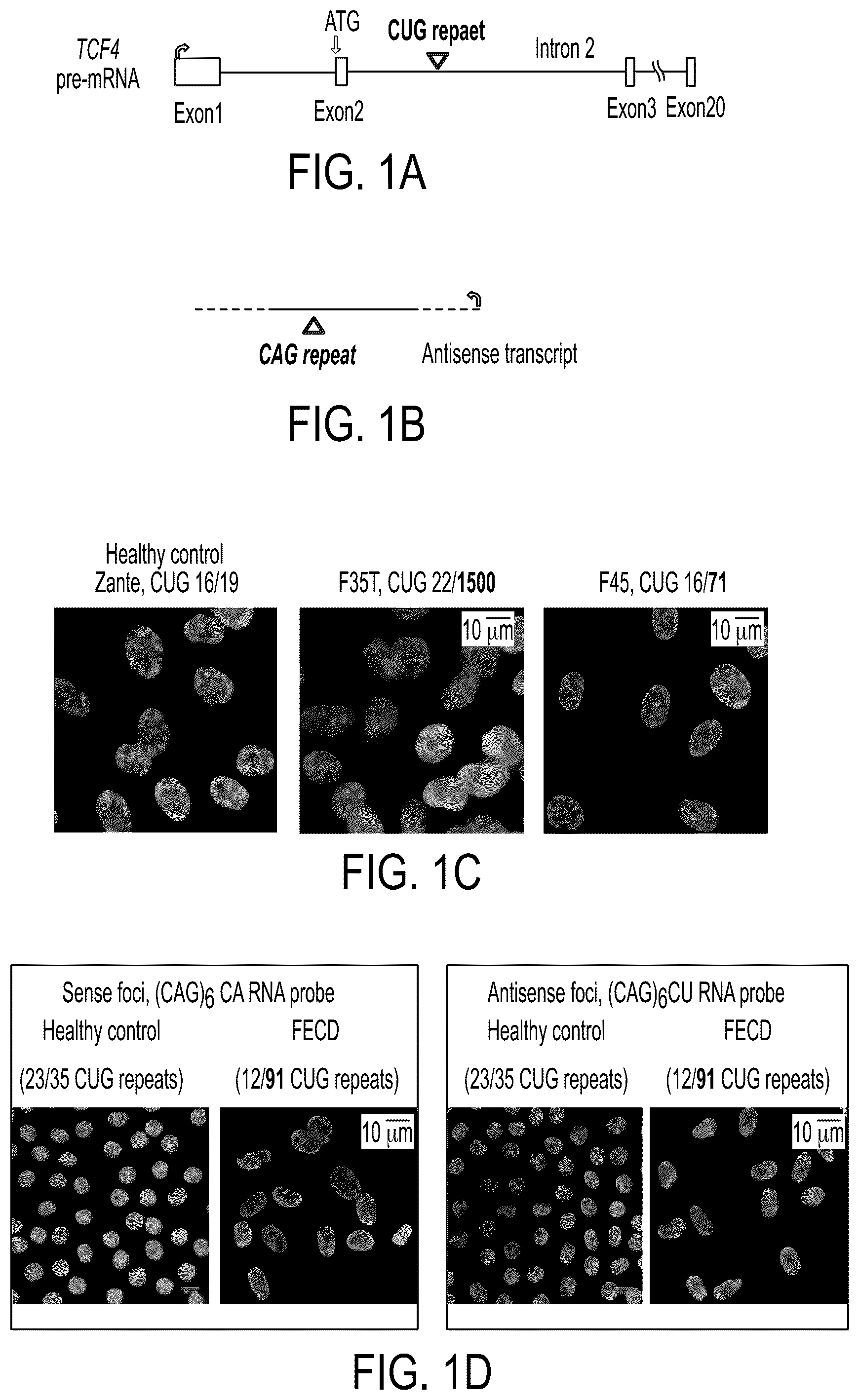 Patent US12480118 Figure 1 – Treatment of Fuchs' endothelial corneal dystrophy