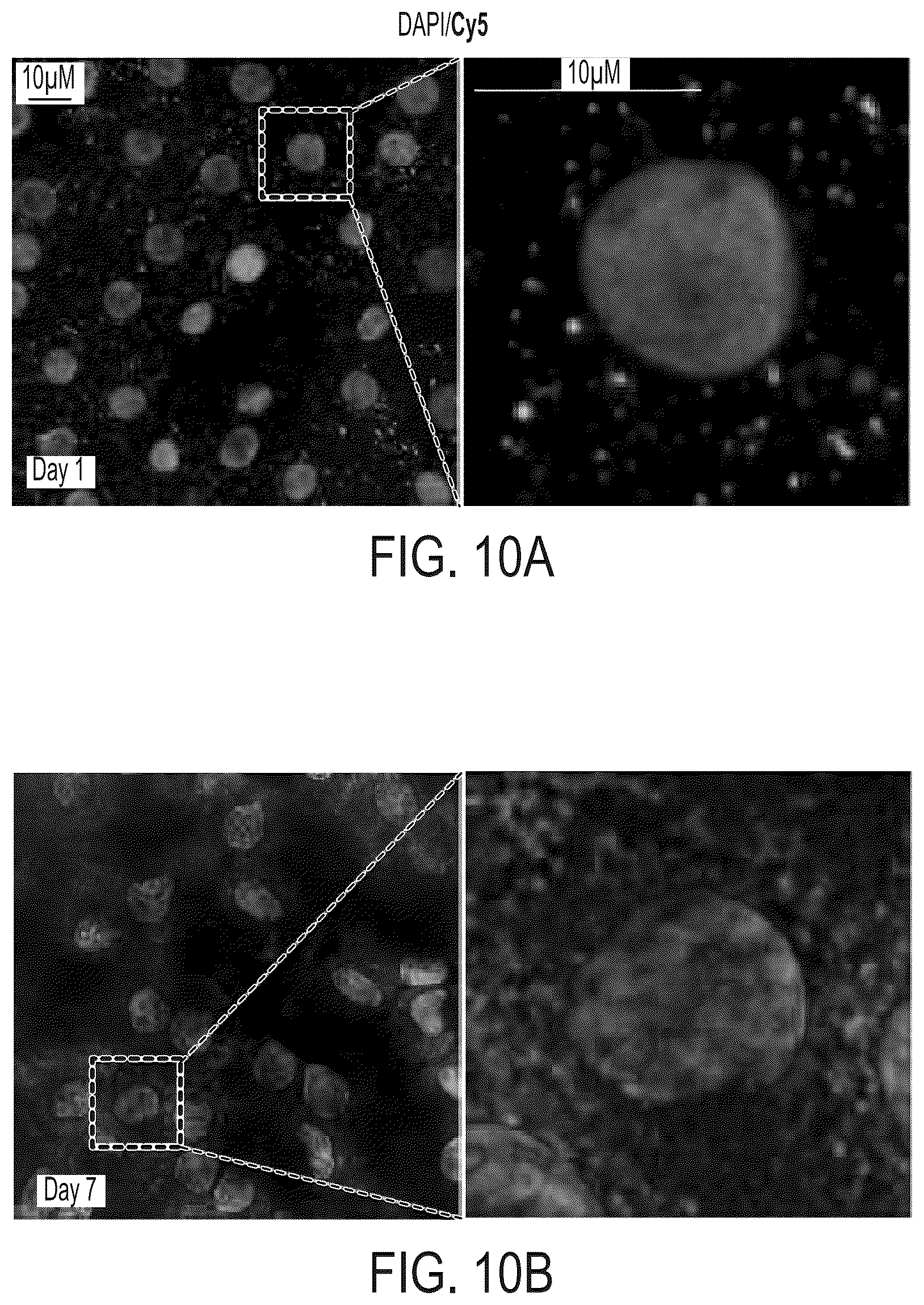 Patent US12480118 Figure 13 – Treatment of Fuchs' endothelial corneal dystrophy