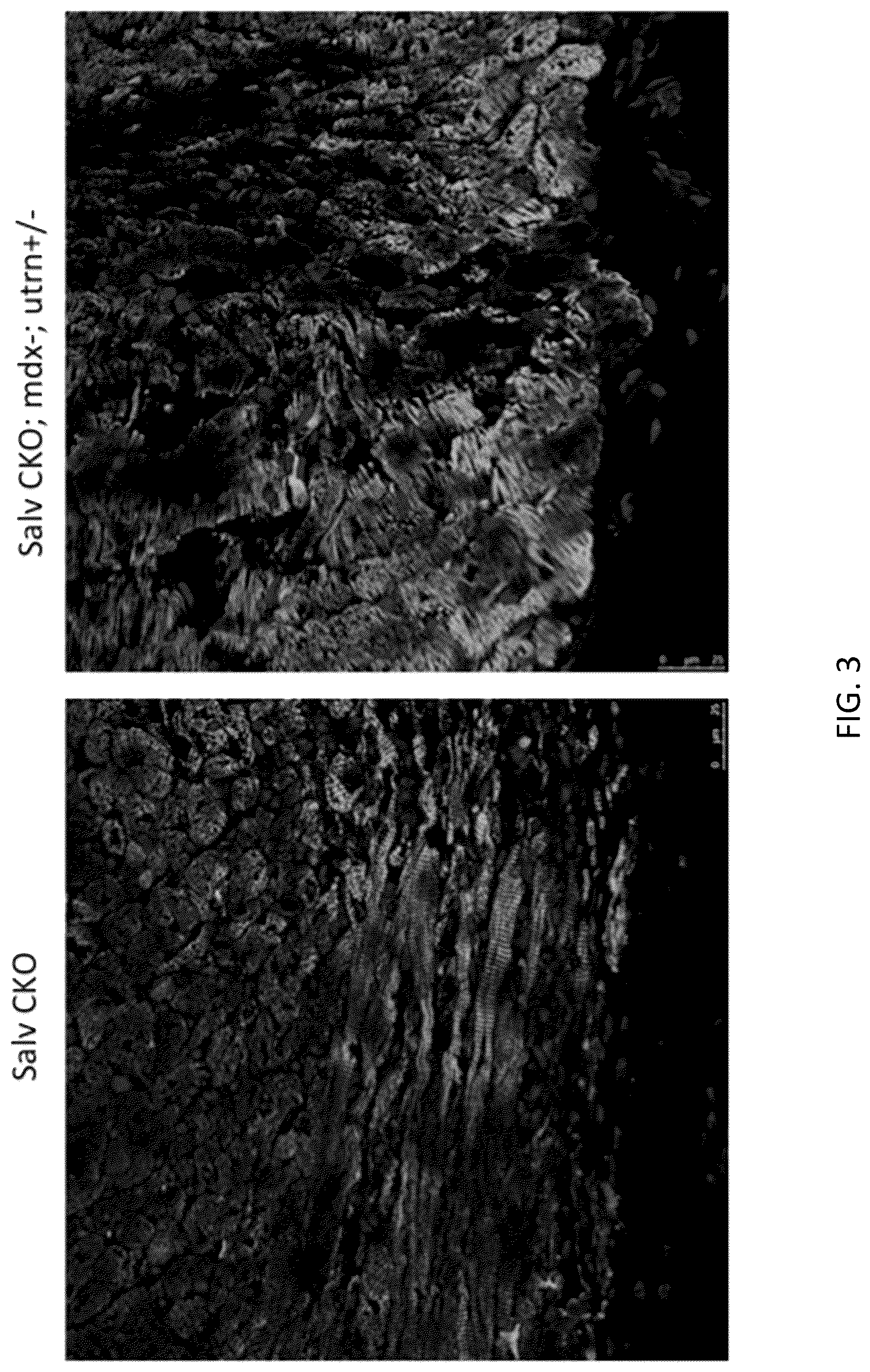 Patent US12480120 Figure 3 – Hippo and dystrophin complex signaling in cardiomyocyte renewal