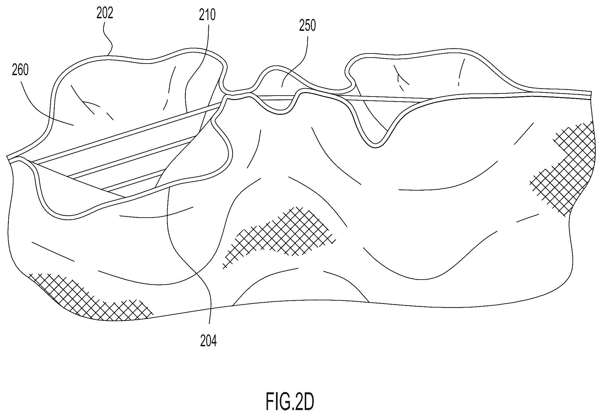 Patent US12480234 Figure 3 – Method of forming an upper for an article of footwear