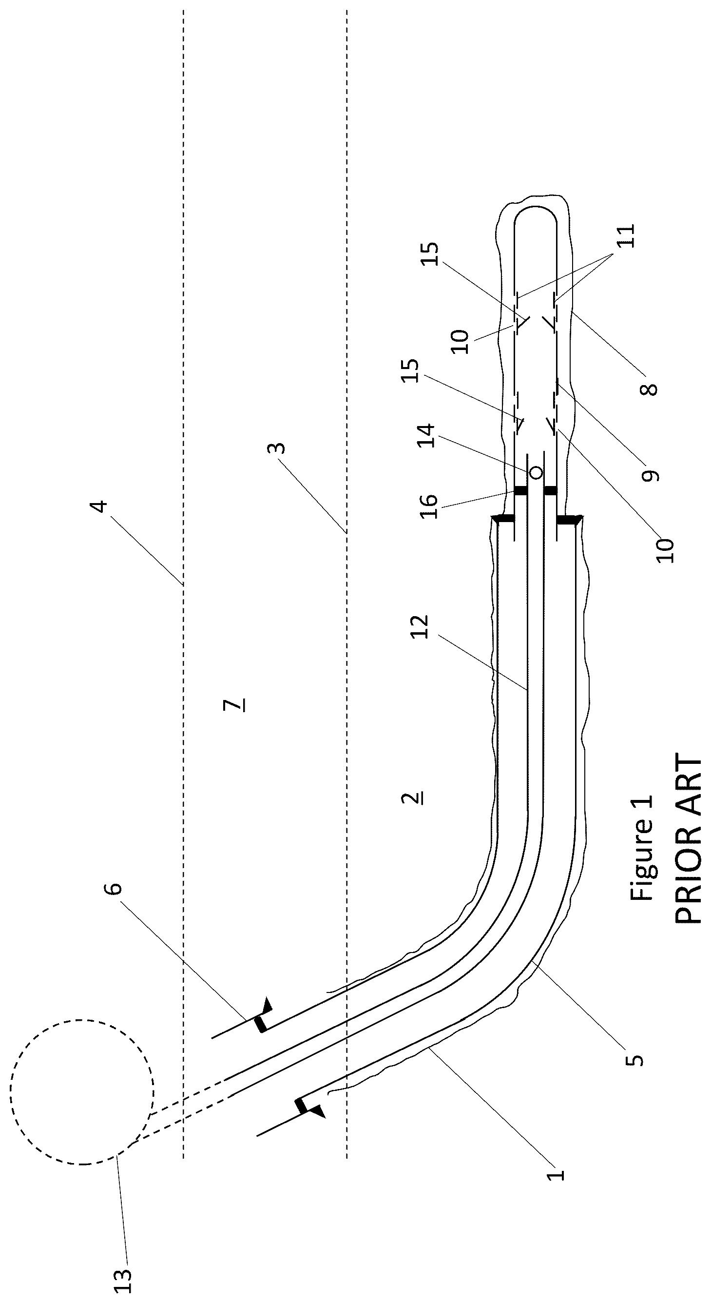 Patent US12480394 Figure 1 – Method and apparatus for acid stimulation