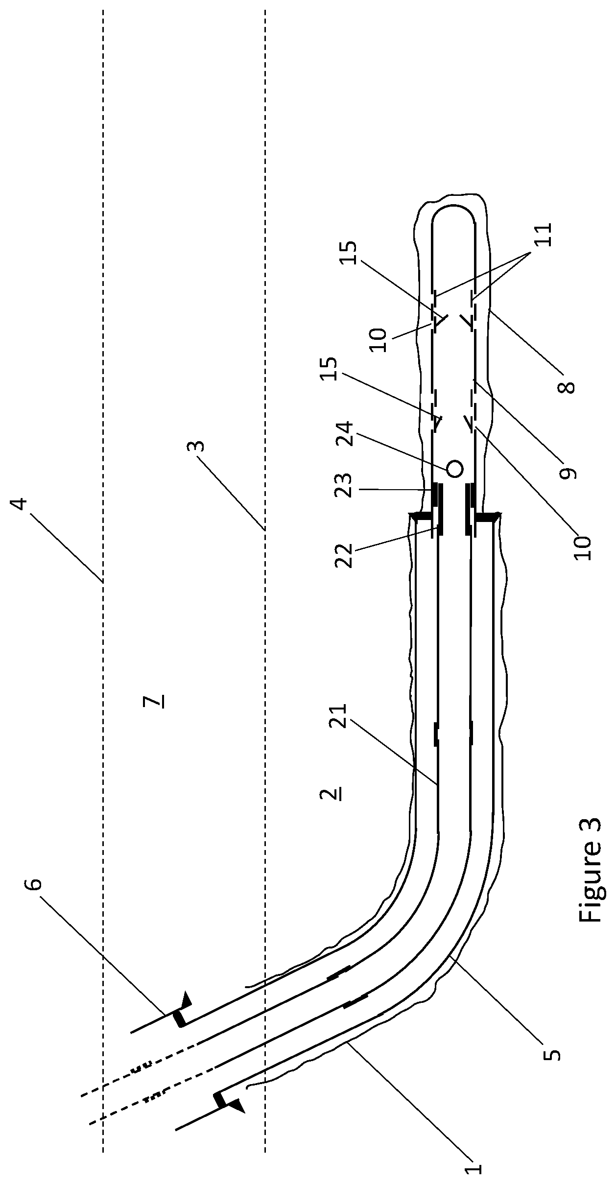 Patent US12480394 Figure 3 – Method and apparatus for acid stimulation