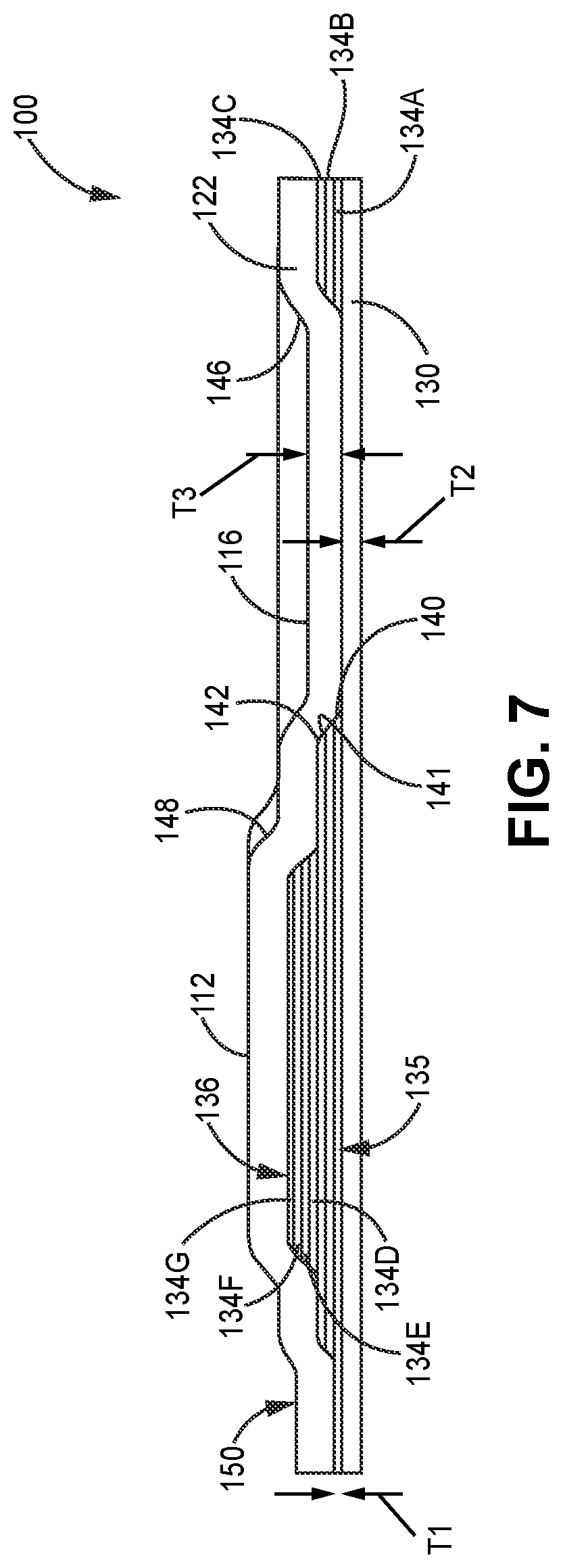 Patent US12480412 Figure 5 – Insertion of ceramic members for gas path endwall contouring