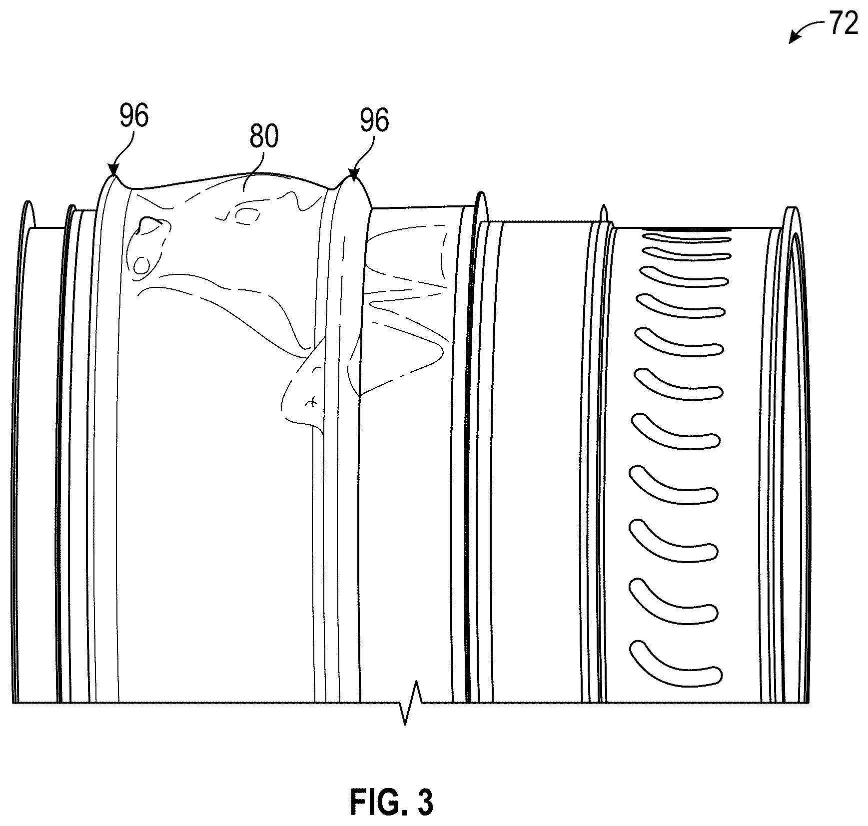Patent US12480426 Figure 3 – Containment ring for gas turbine engine