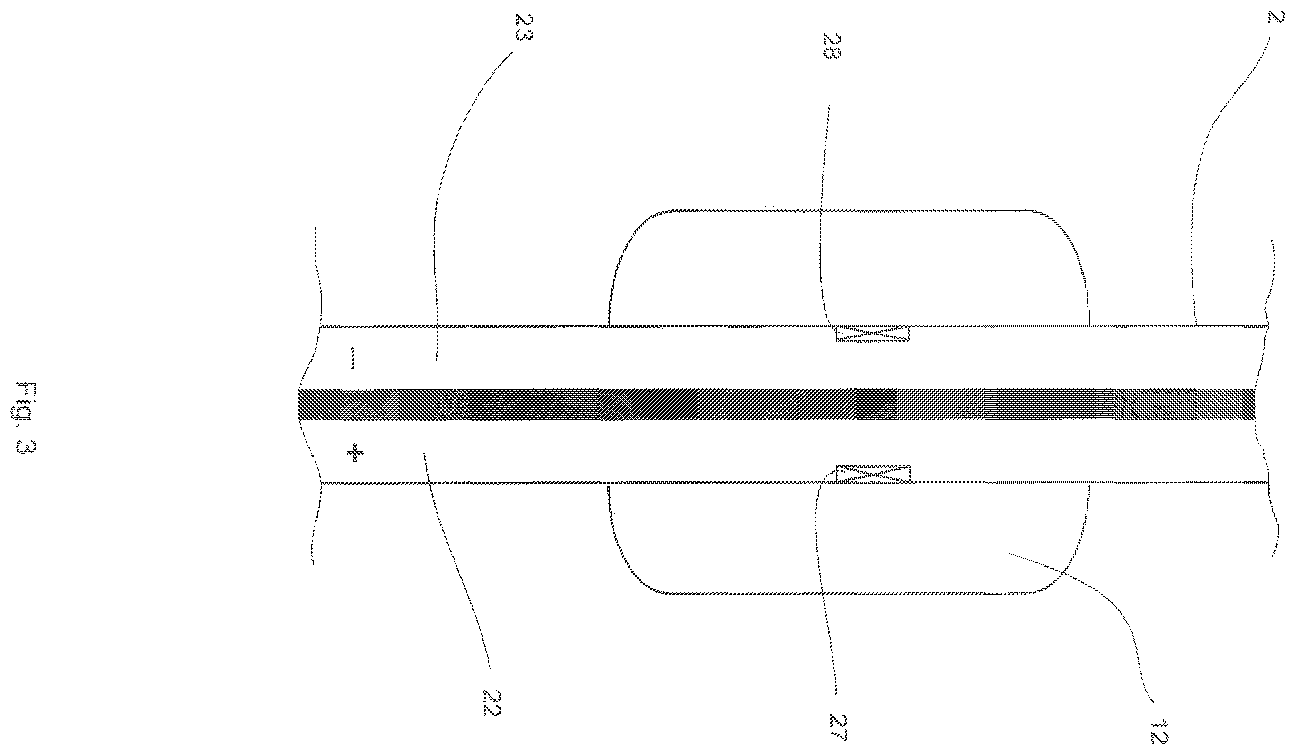 Patent US12480496 Figure 3 – Device to assist the performance of a heart