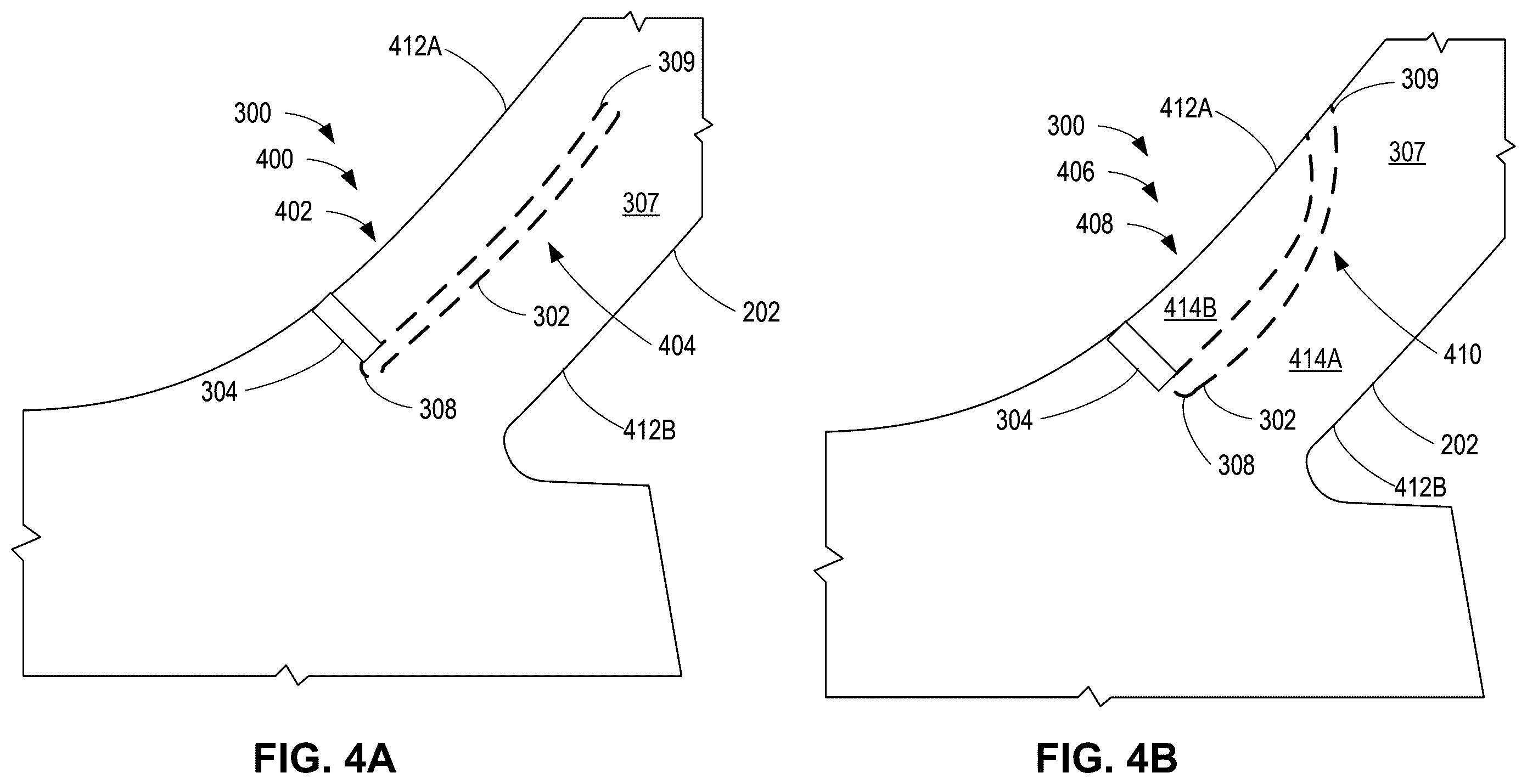 Patent US12480511 Figure 4 – Compressor bleed slots with variable wall structures