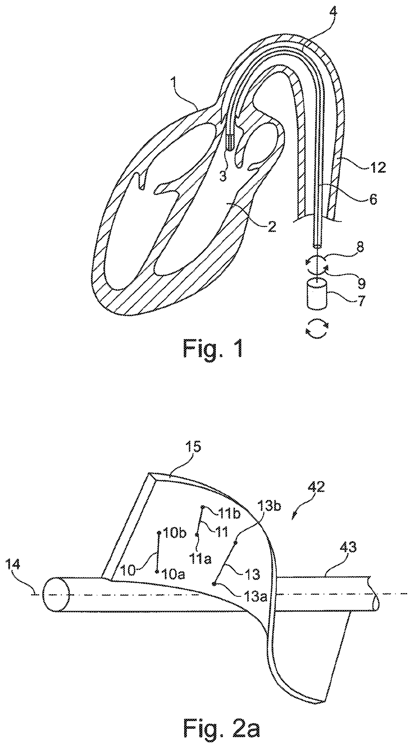 Patent US12480512 Figure 1 – Rotor for a fluid pump and method and mold for the production thereof