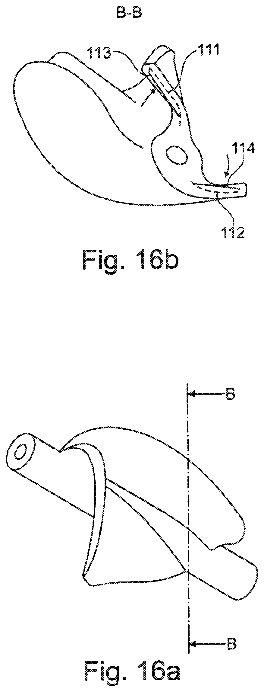 Patent US12480512 Figure 9 – Rotor for a fluid pump and method and mold for the production thereof